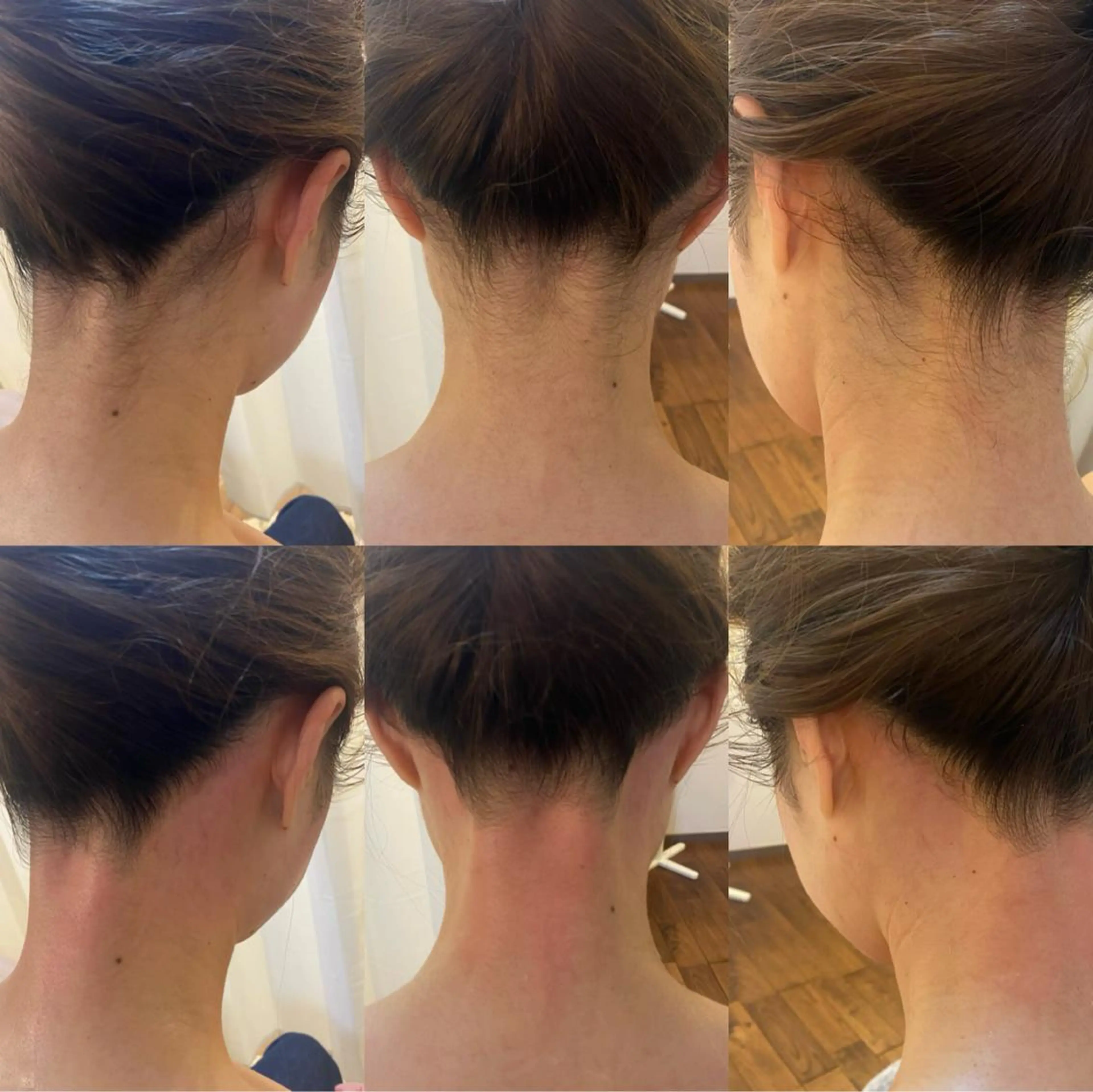 脱毛 BELCIA福岡店　récolte de BELCIA（レコルトデベルシア）所属・BELCIA福岡店 レコルトデベルシアのエステ・リラクイメージ