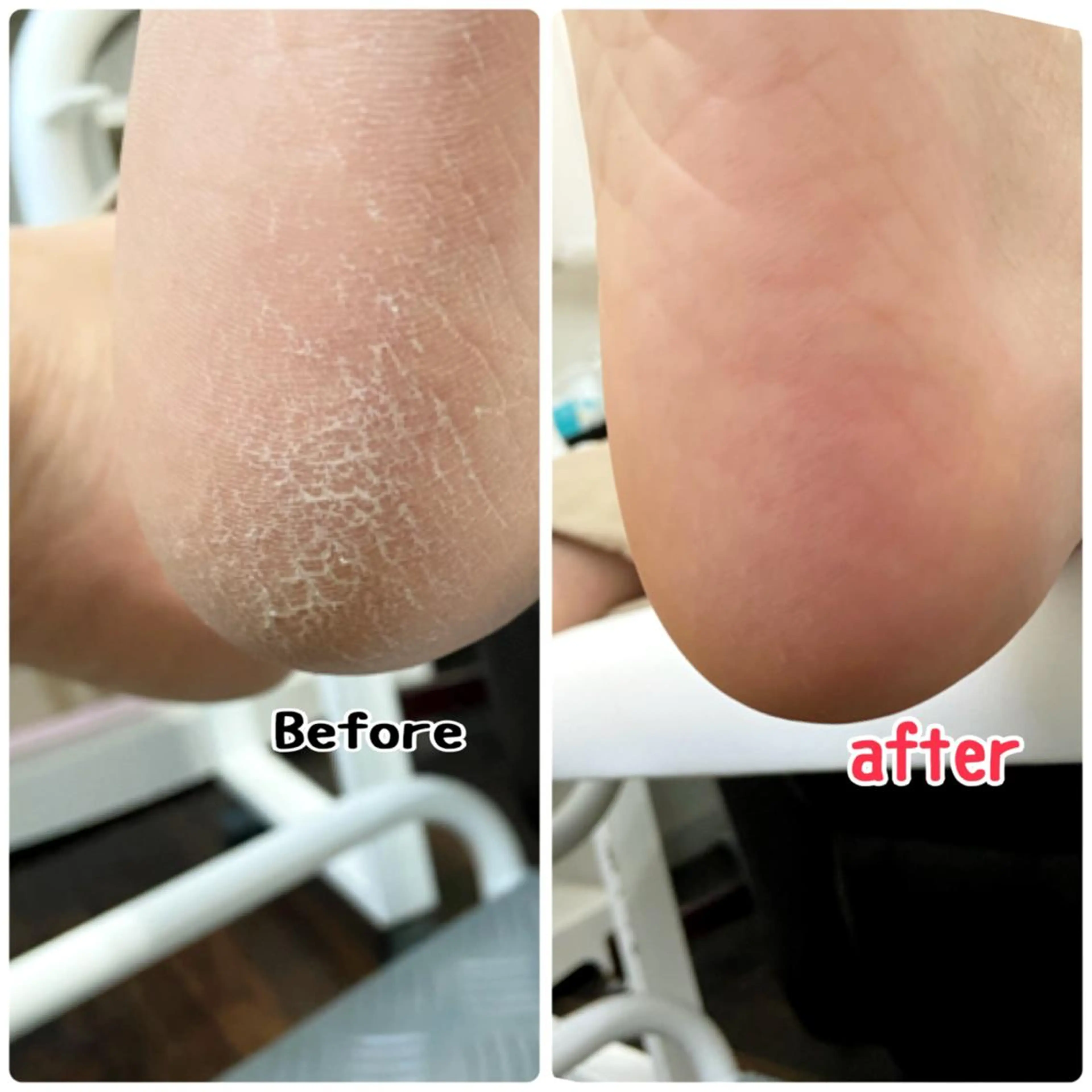 ネイル フットネイル Lotus Nailのネイルデザイン