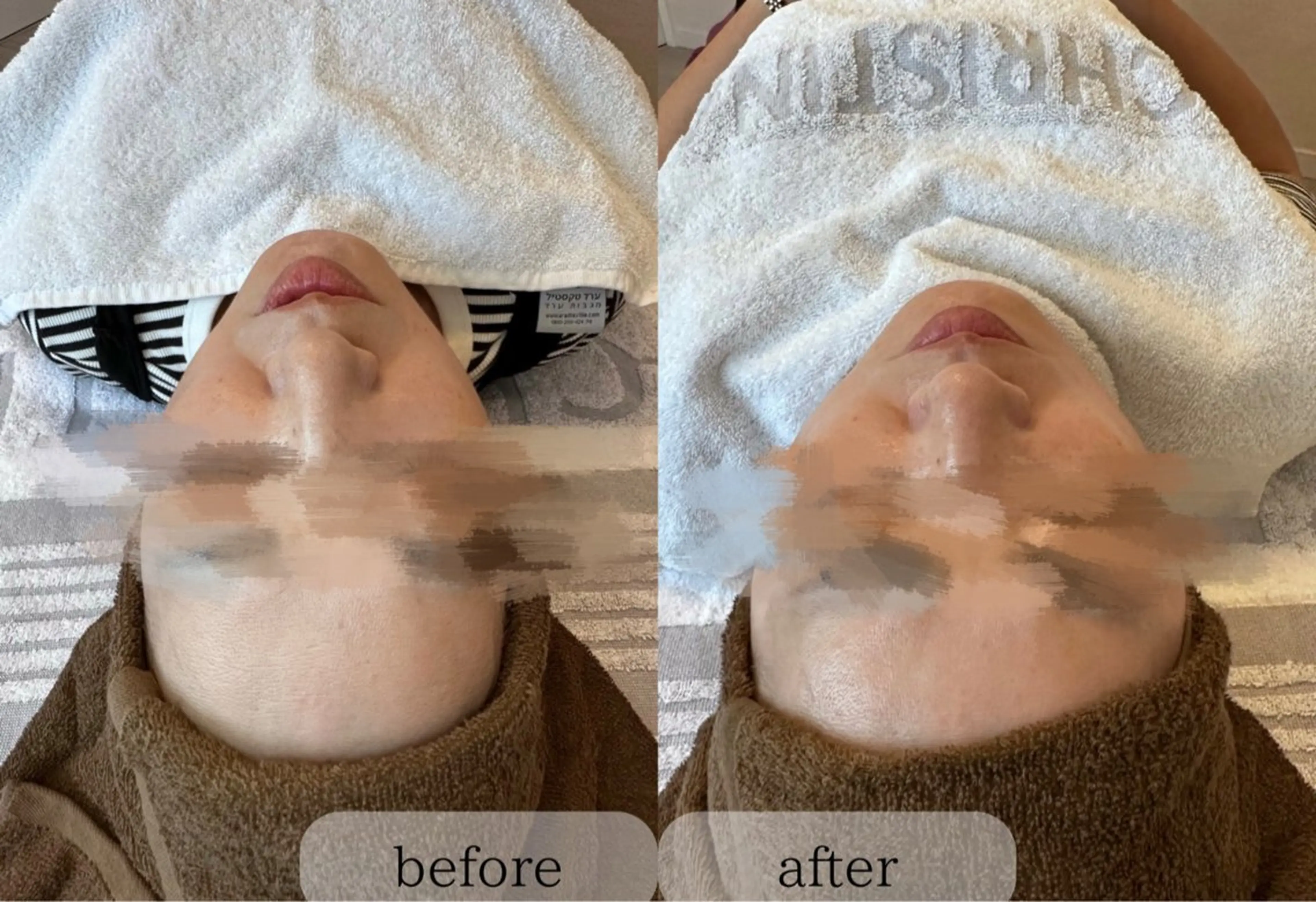 salon moi(モア)のエステ・リラクイメージ