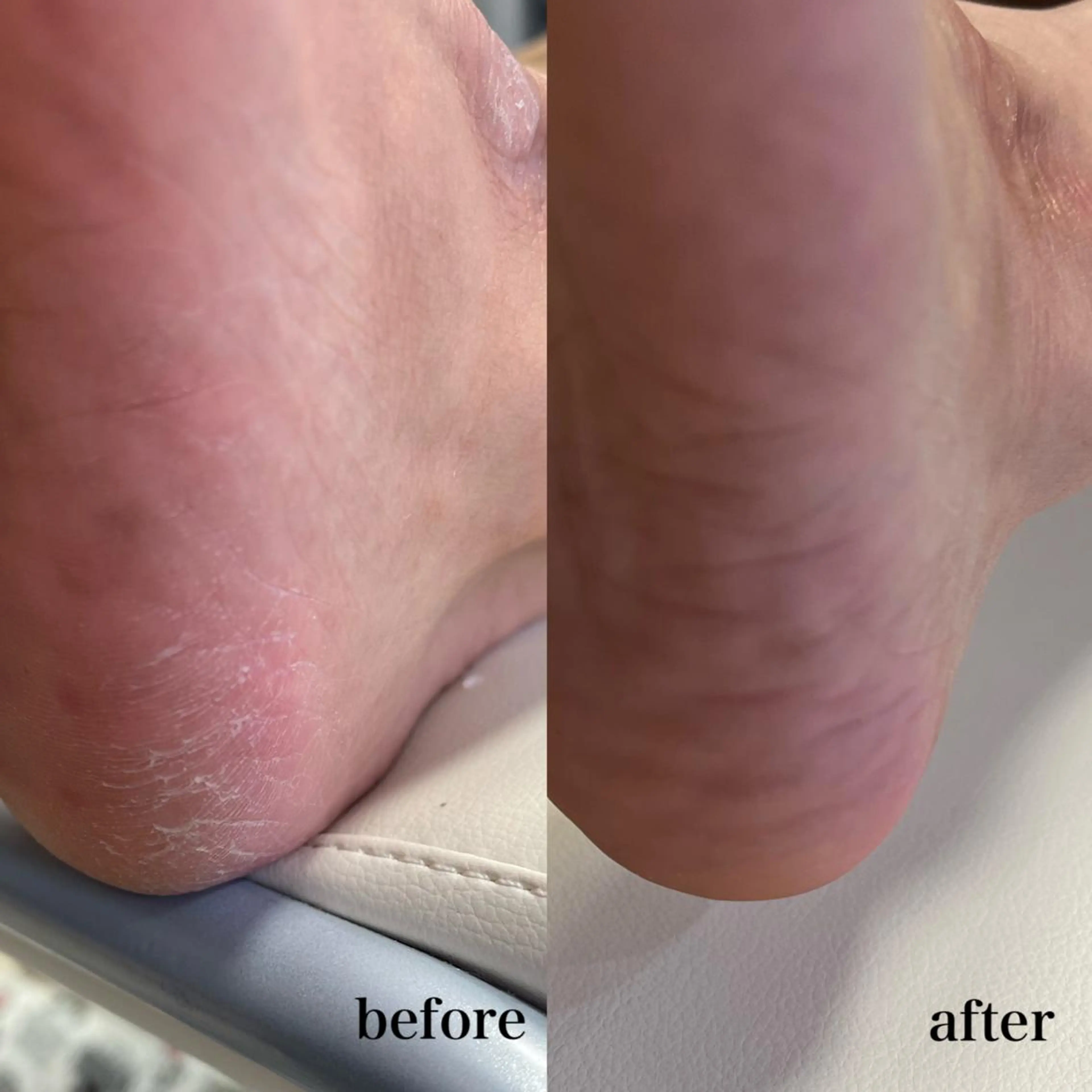 𝐑𝐢𝐞𝐯𝐞所属・HIROTA 𝐑𝐀𝐍のエステ・リラクイメージ