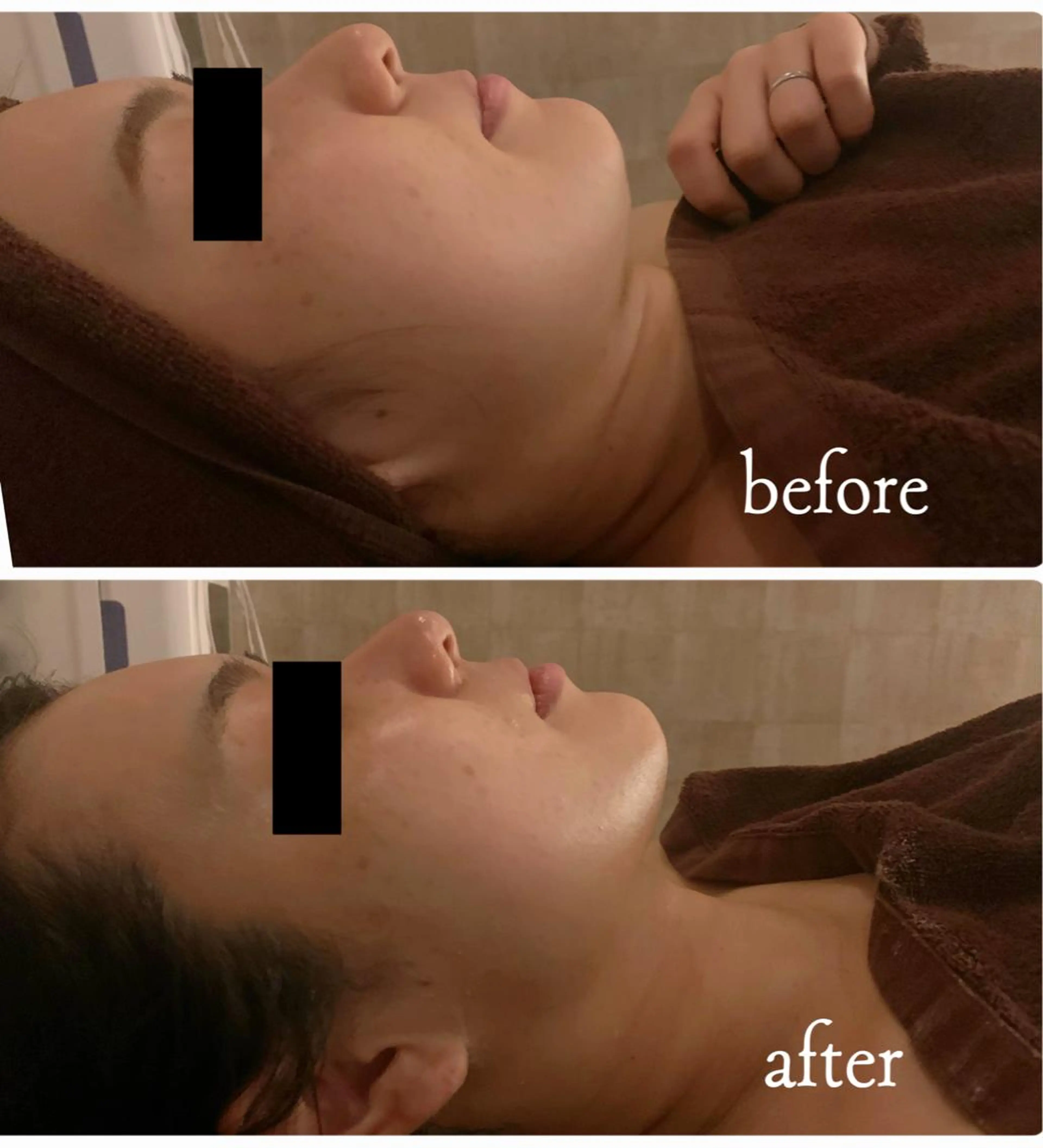 【お肌の引き締め・くすみをごっそり飛ばす❣️】25歳からのエイジングケア✨️オールハンドで輪郭矯正をしながら肌質改善🫧の写真