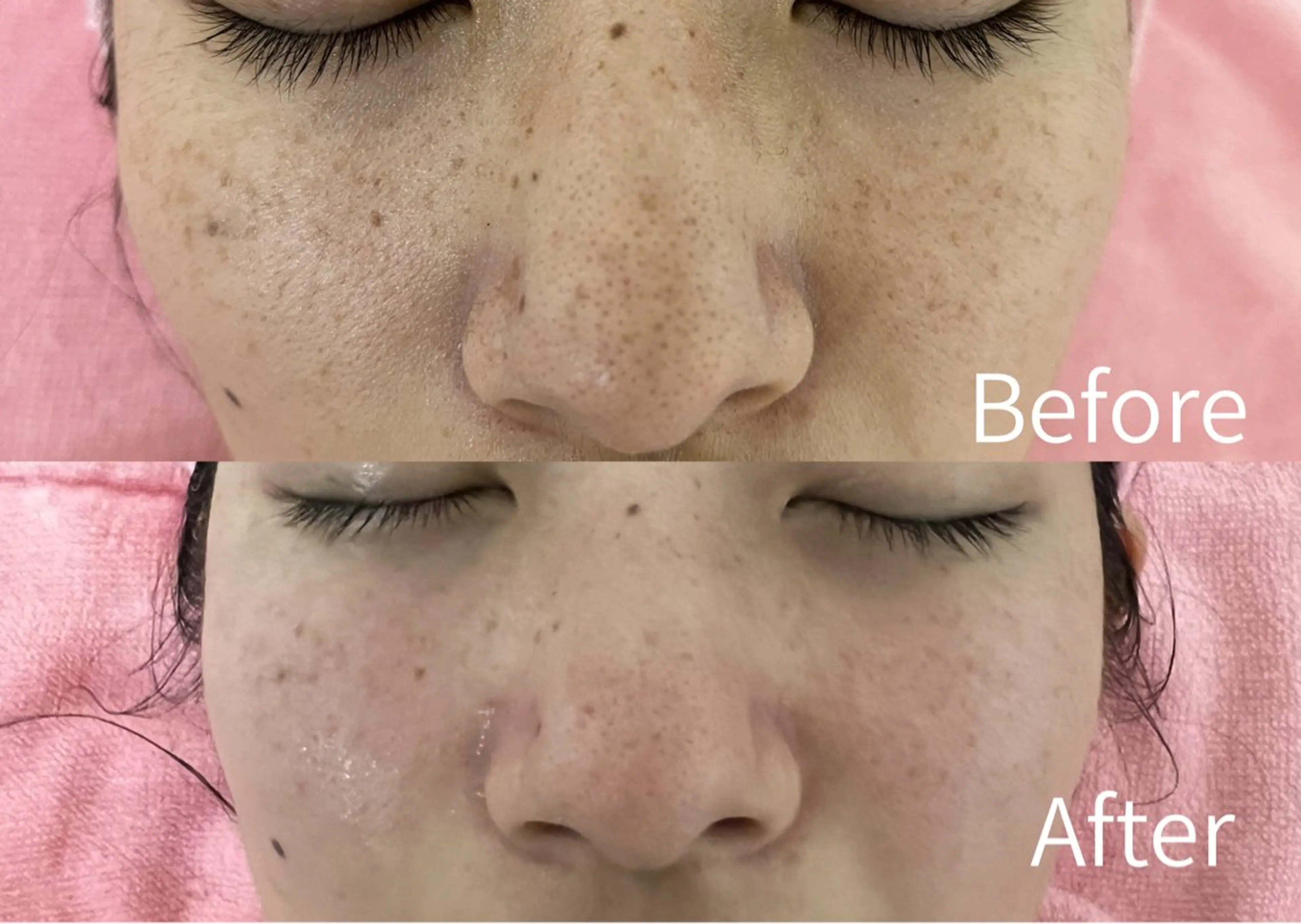 Rassurer 山本のエステ・リラクイメージ