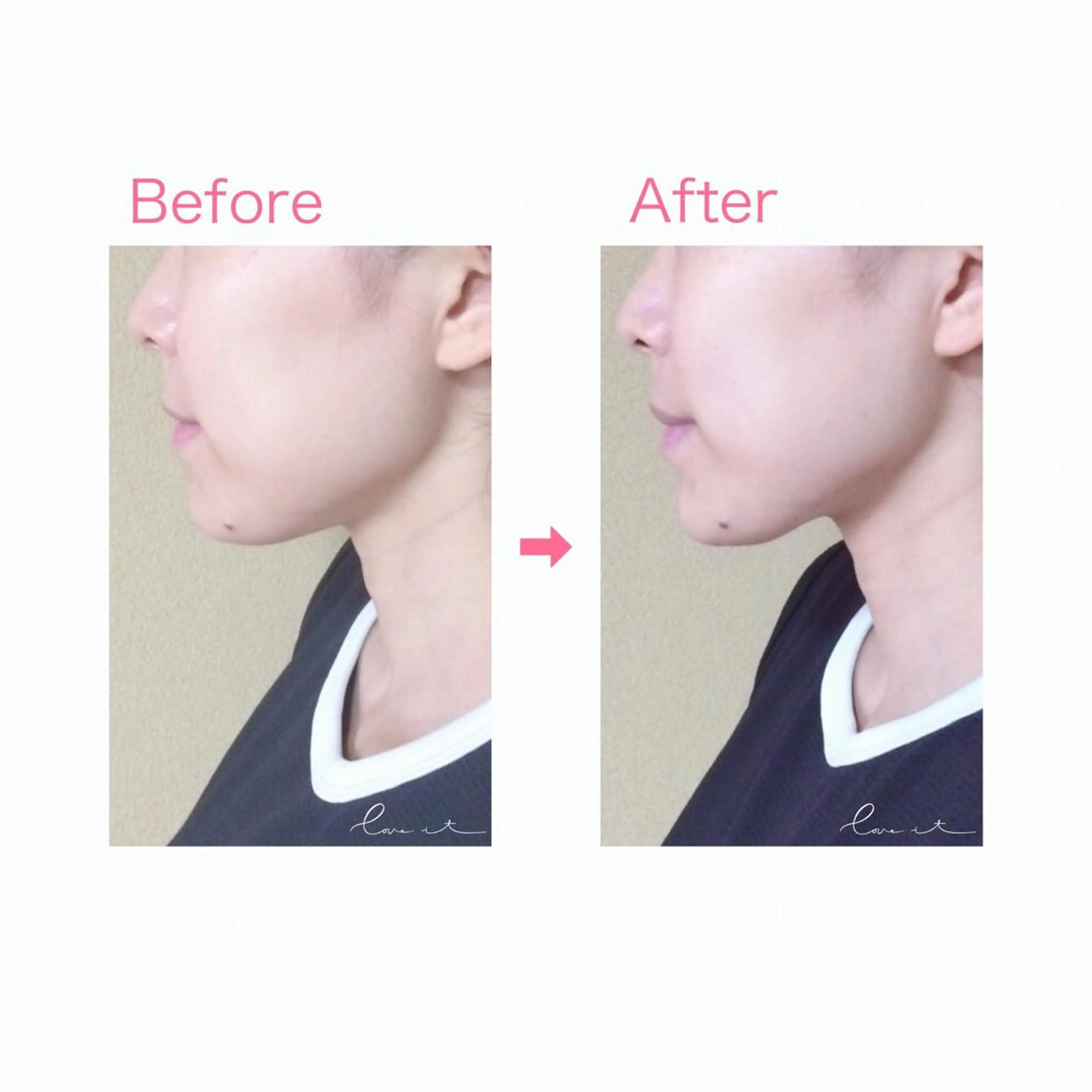 Lov. it ラヴィットのエステ・リラクイメージ