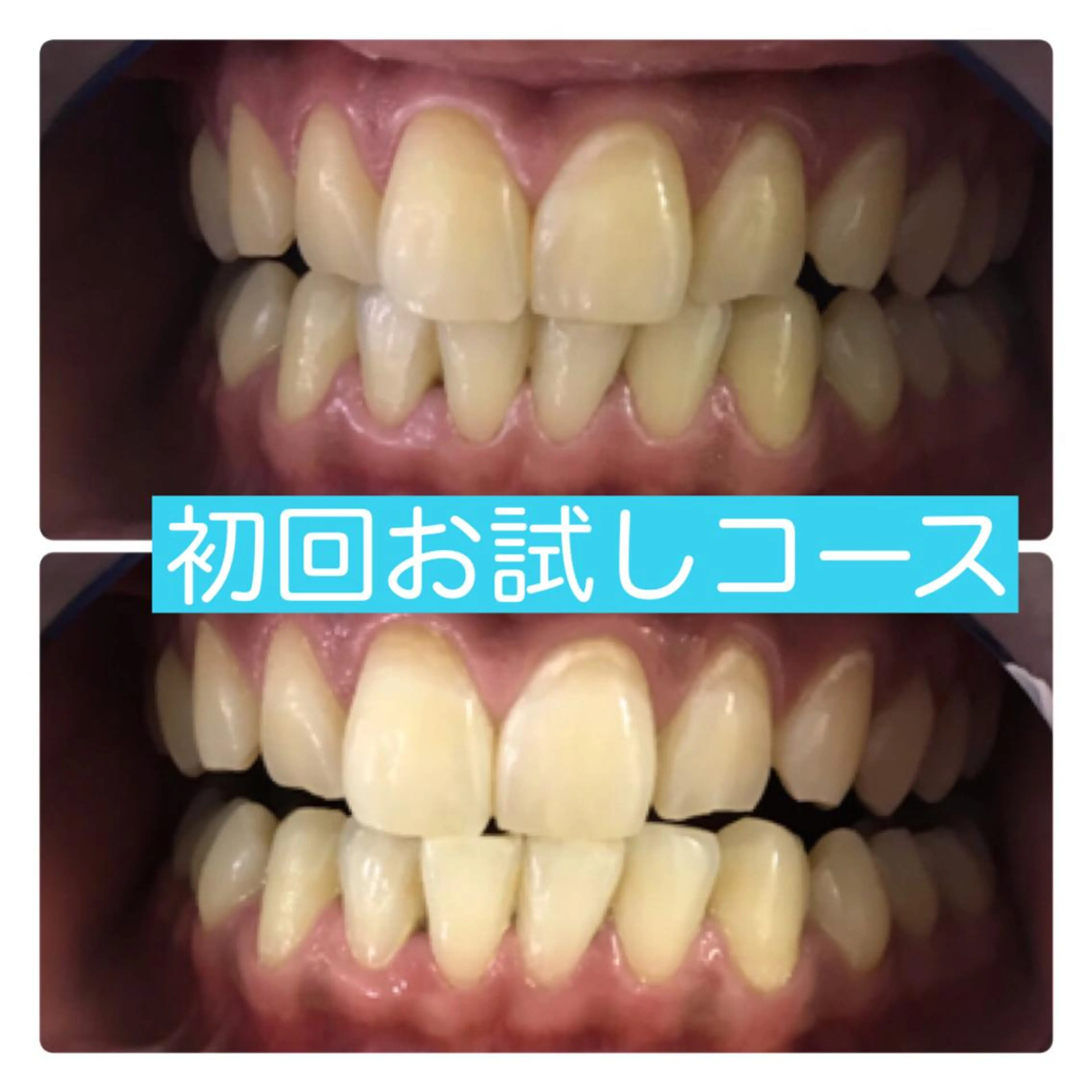 PLATINUM Beauty 横浜店所属・ホワイトニングルーム 横浜店のその他イメージ