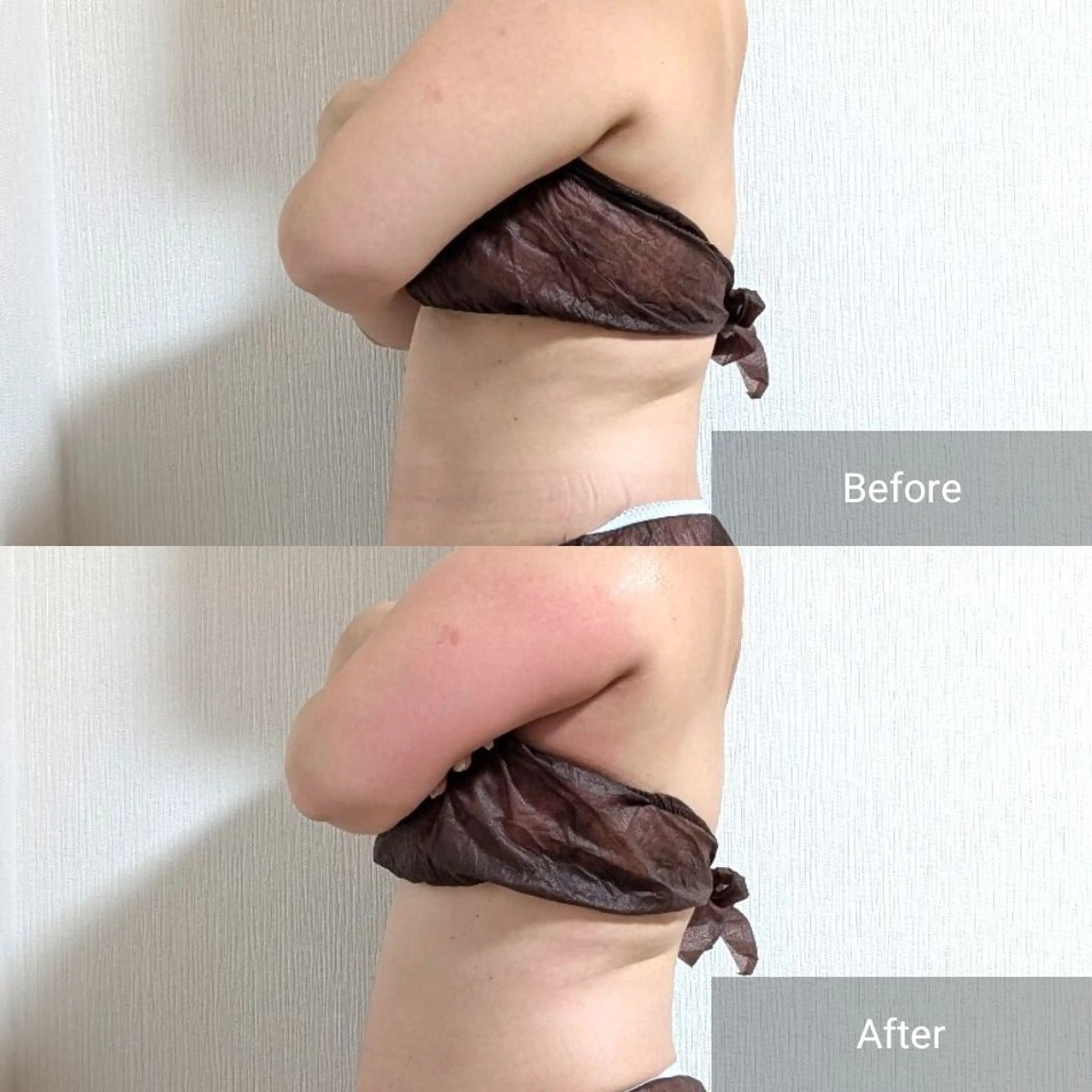 エステ nail RiRi アトレナチュラのエステ・リラクイメージ