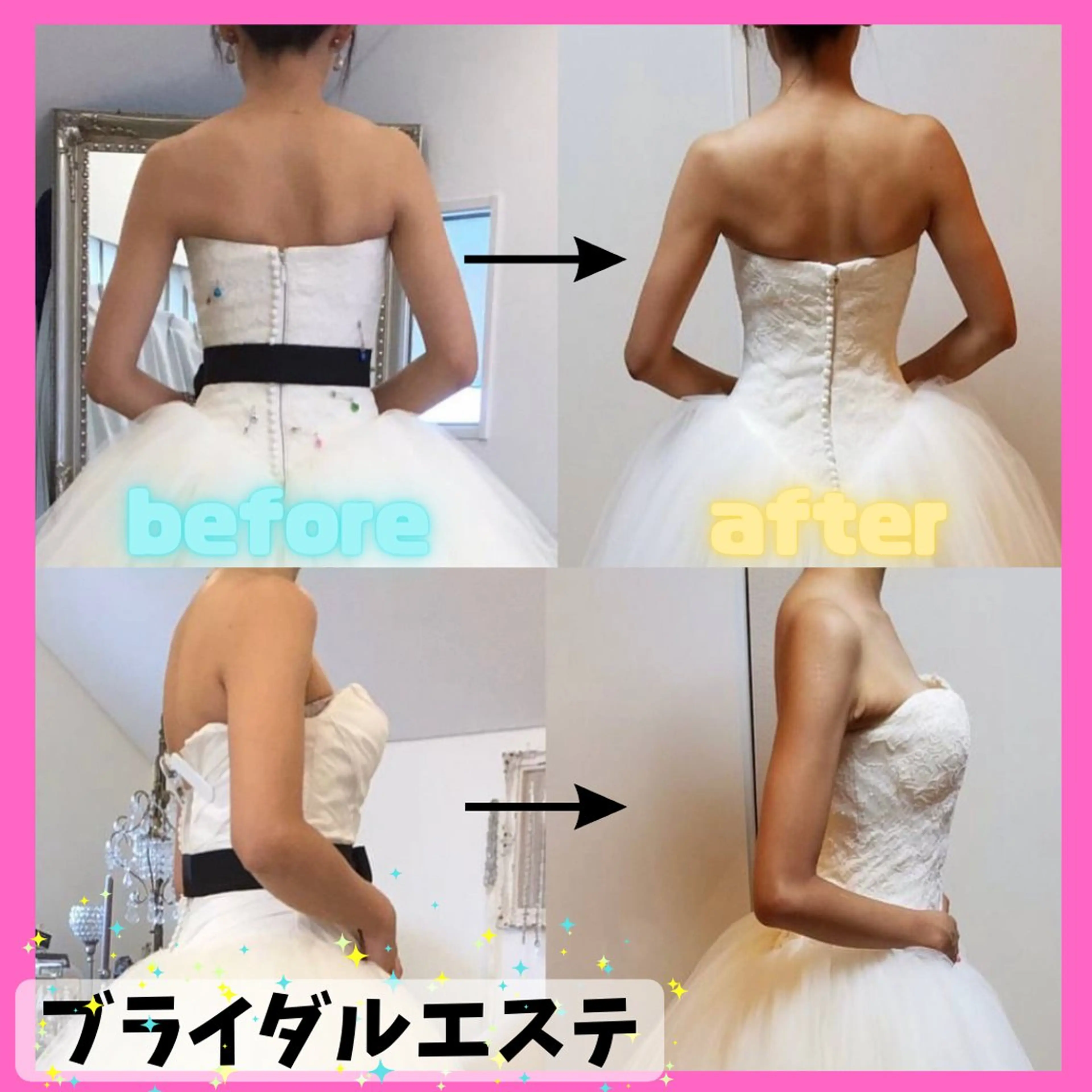 ˗ˏˋ大人気ホームケア付きˎˊ˗ 頑張る花嫁様を全力でお手伝い✨背中&二の腕のお肉をしっかり落とす🪄の写真