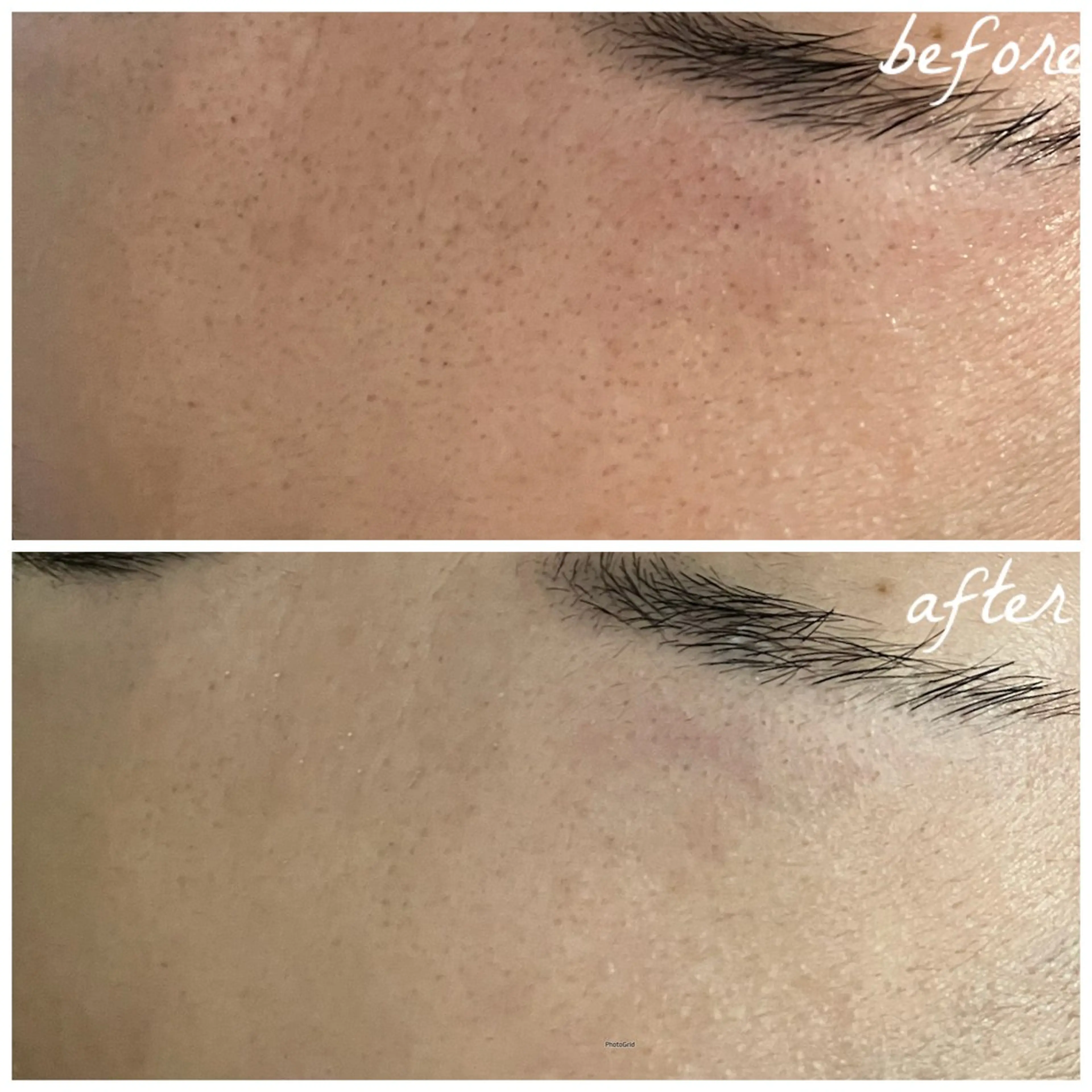 メンズ エステ メナード岐阜茜部 杉浦のエステ・リラクイメージ