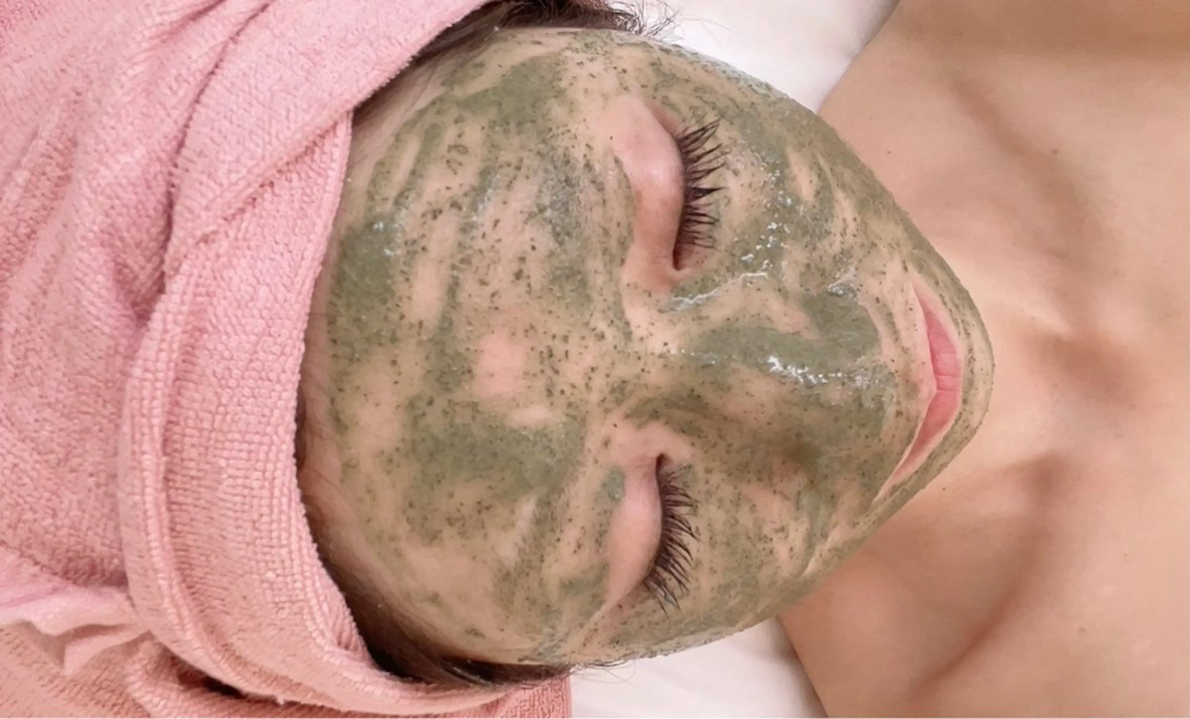 【minimo限定】お試し★REVI🌹陶肌トリートメント🌿次世代ハーブピーリング🌿剥離無し・ダウンタイム無し◎の写真