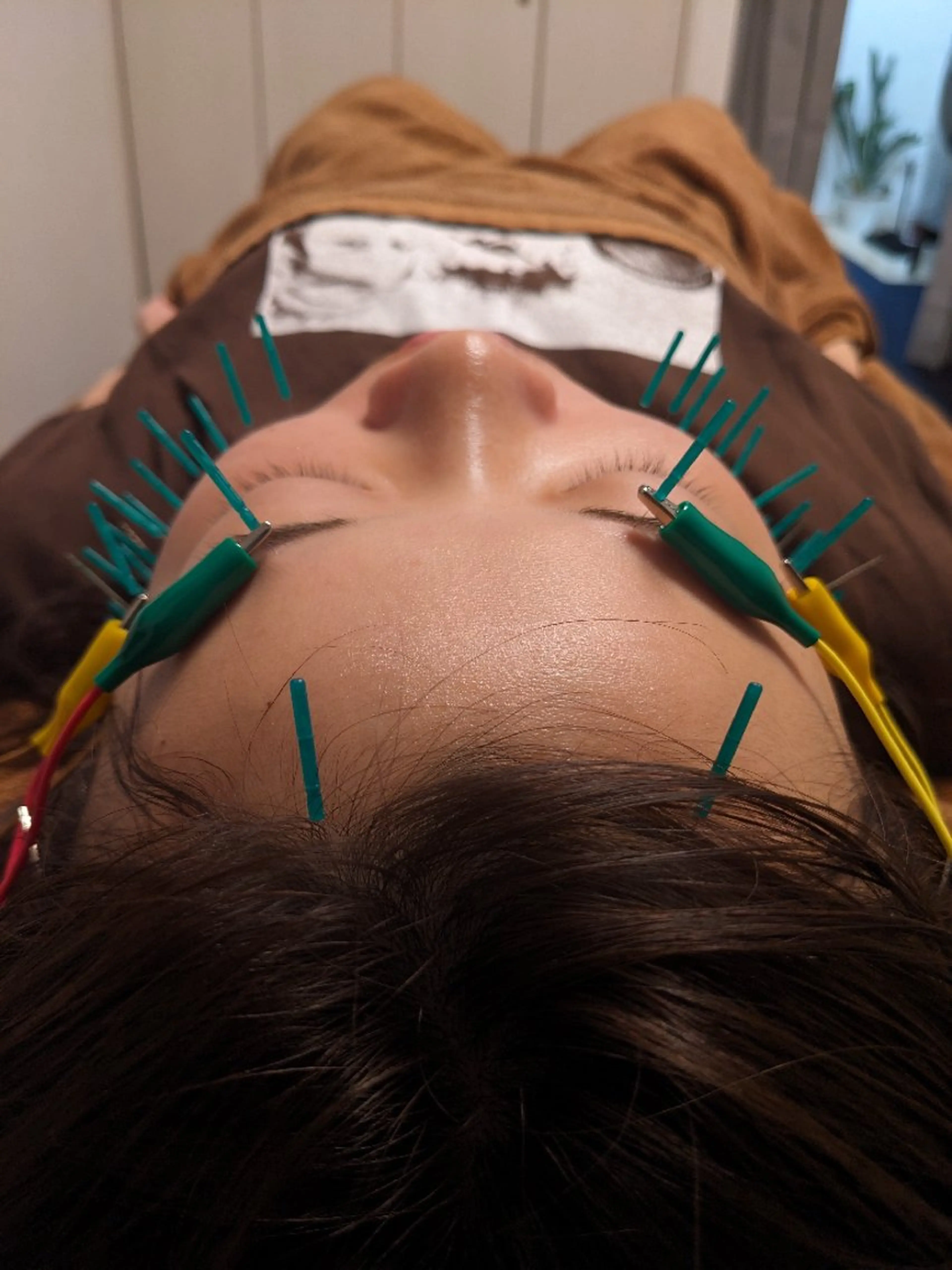 エステ リラク 乃々鍼灸・整体院　表参道所属・乃々鍼灸整体院　植木 　【美容鍼/整体】のエステ・リラクイメージ