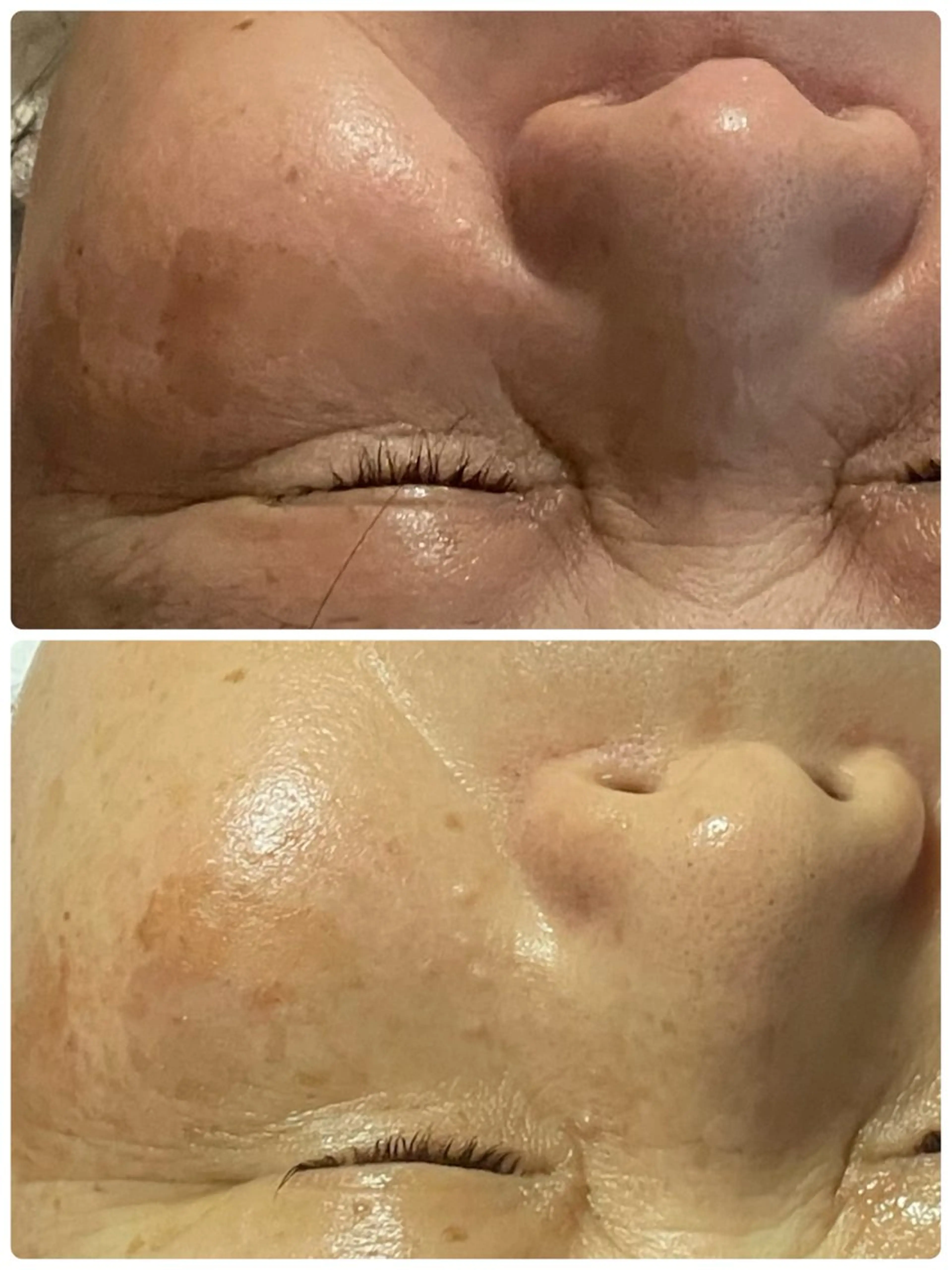 Salon Rion所属・Rion 野々村のエステ・リラクイメージ