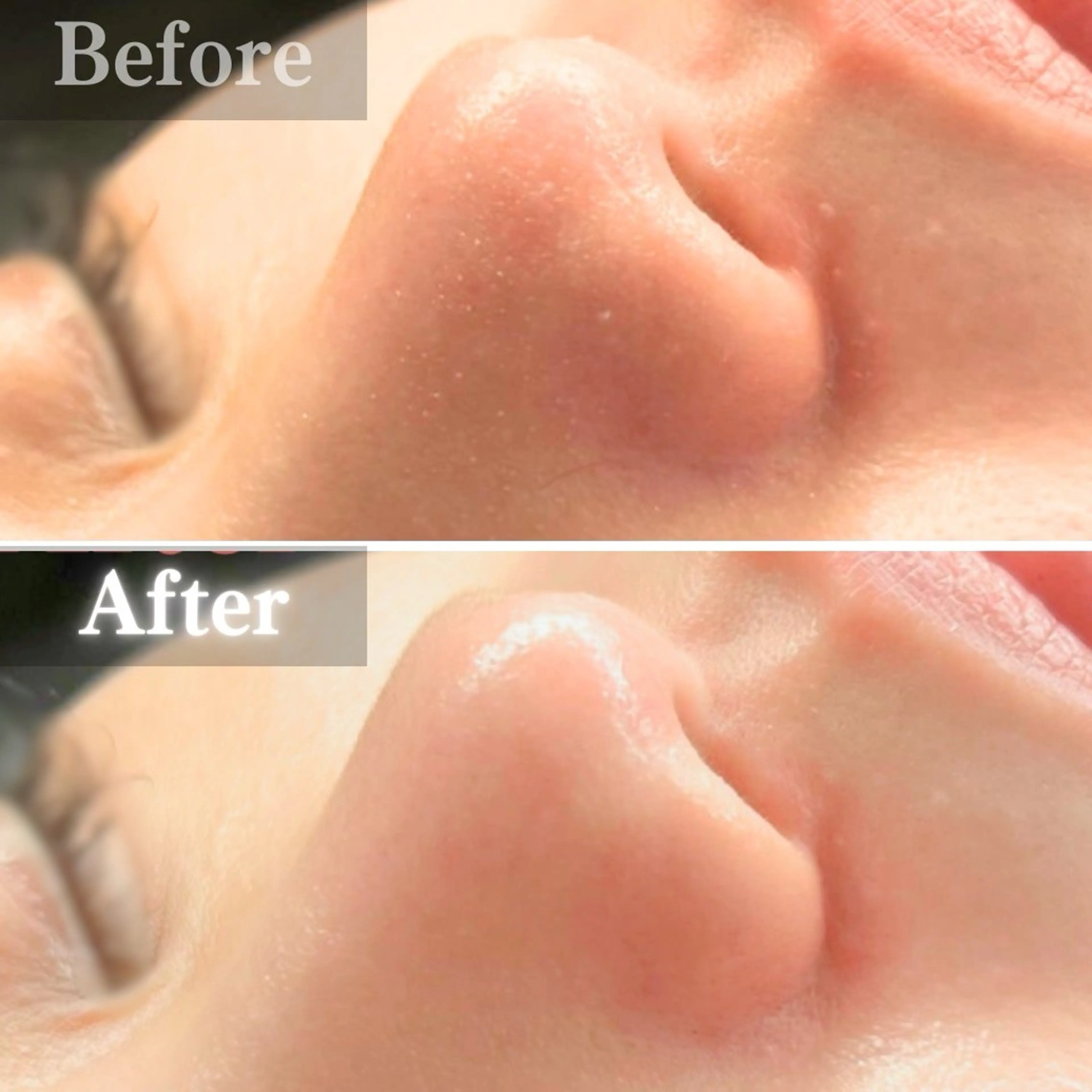 エステ 毛穴洗浄特化🫧 オオツカのエステ・リラクイメージ