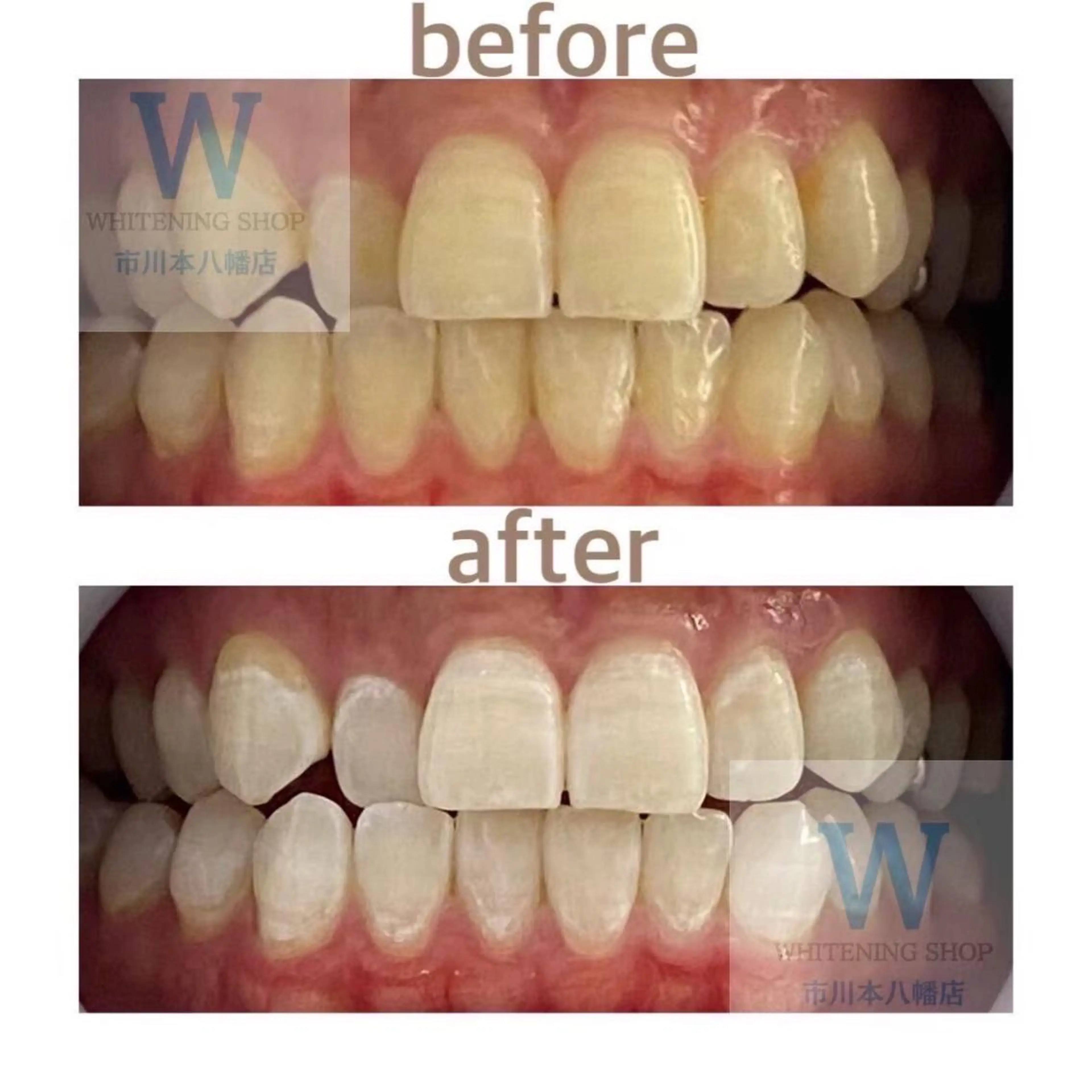 ホワイトニング ショップ本八幡店のエステ・リラクイメージ