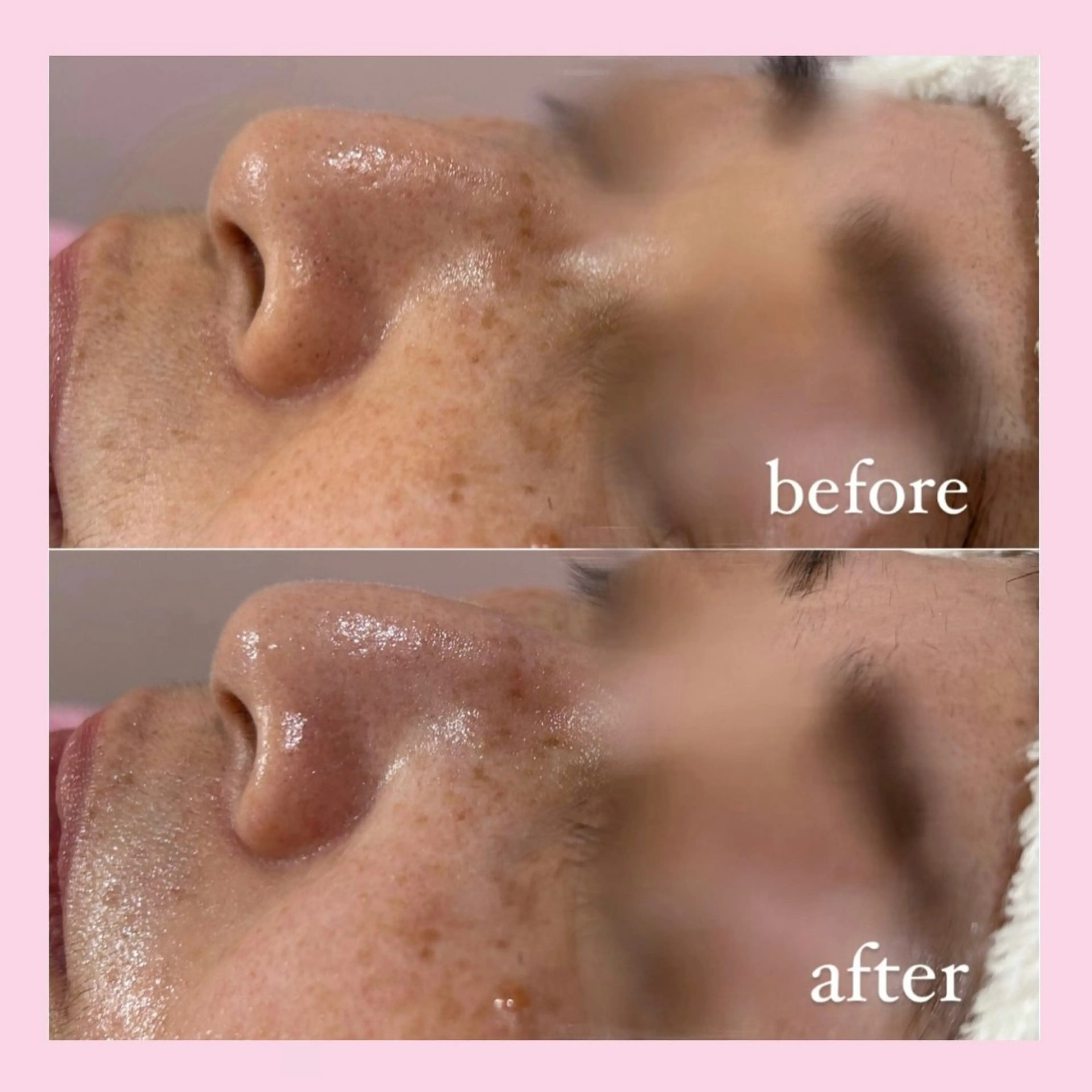 エステ 韓国肌管理専門店　White labo 宝塚店所属・有川 凜のエステ・リラクイメージ