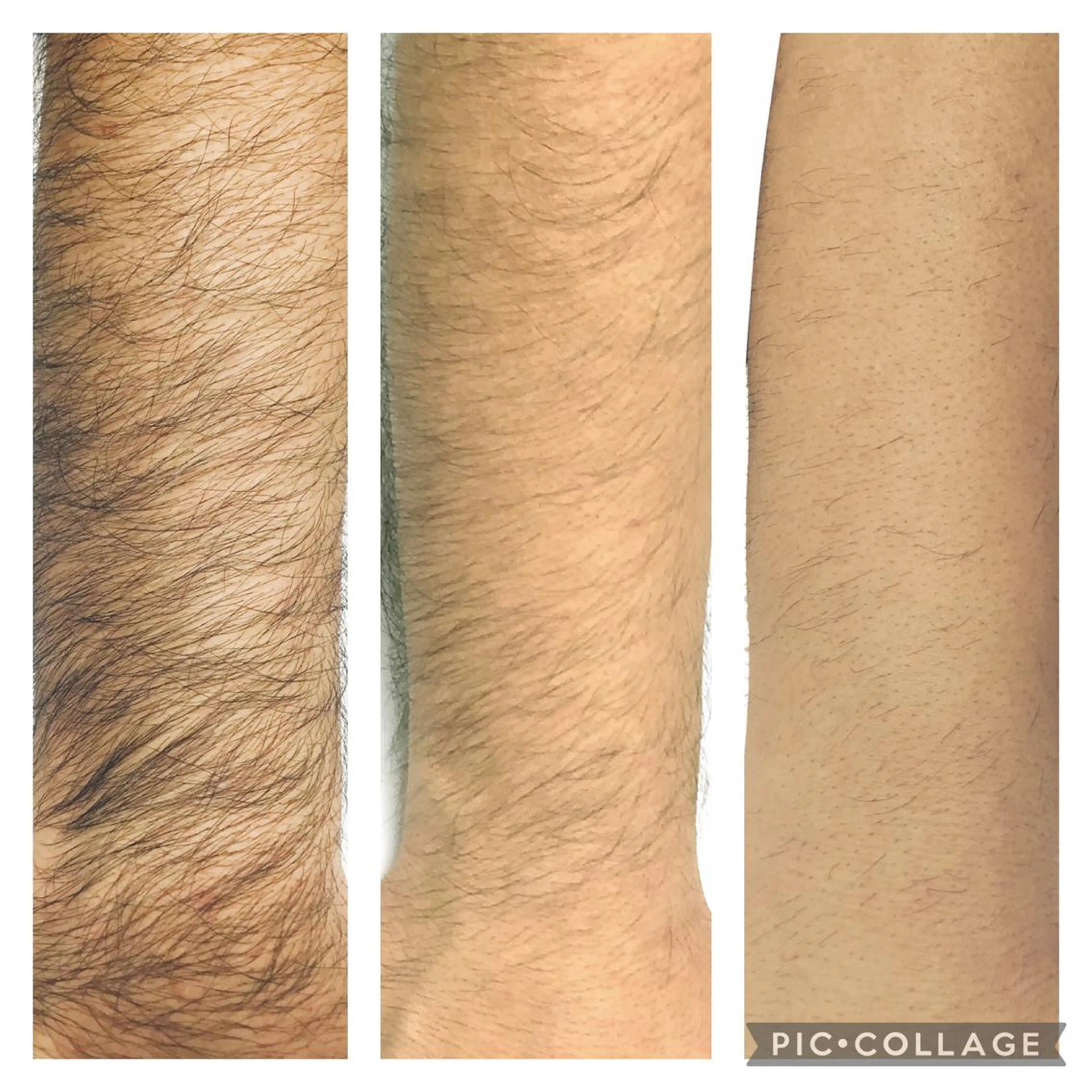 脱毛 セルフホワイトニングCOCOSHIRO所属・セルフホワイトニング COCOSHIROのエステ・リラクイメージ