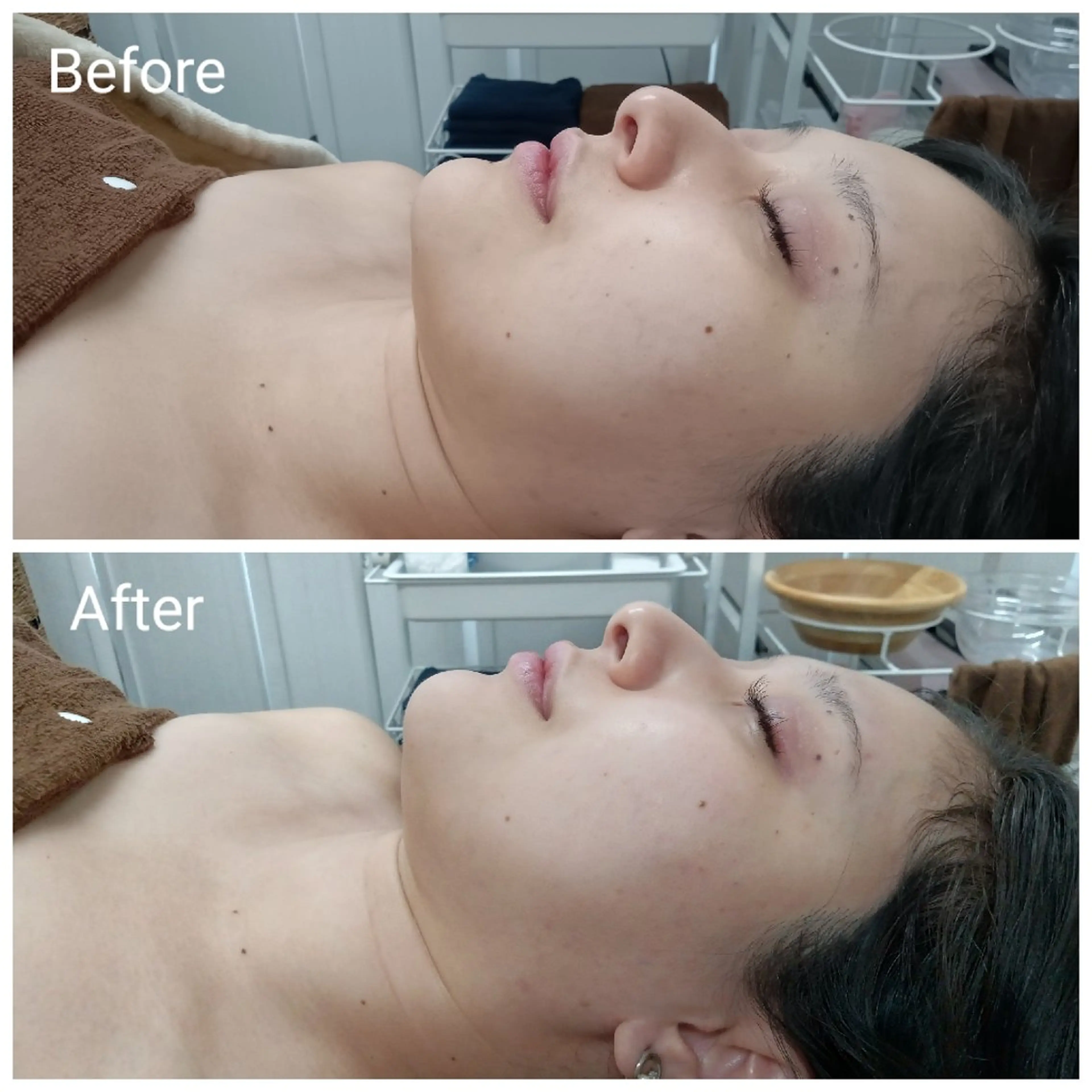 エステ リラク 肌質改善Beauty salon Renのエステ・リラクイメージ