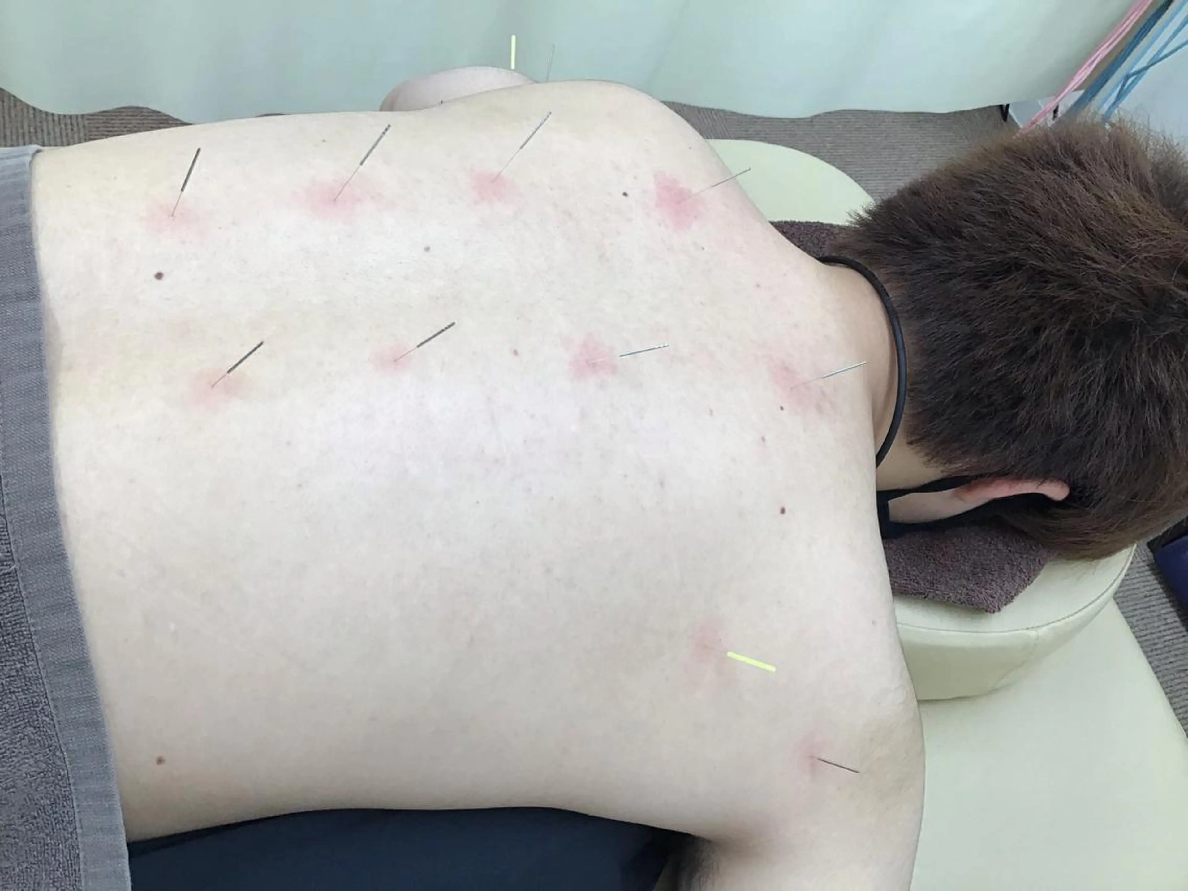 エステ リラク まごころ鍼灸整骨院所属・まごころ鍼灸整骨院 京王堀之内院のエステ・リラクイメージ