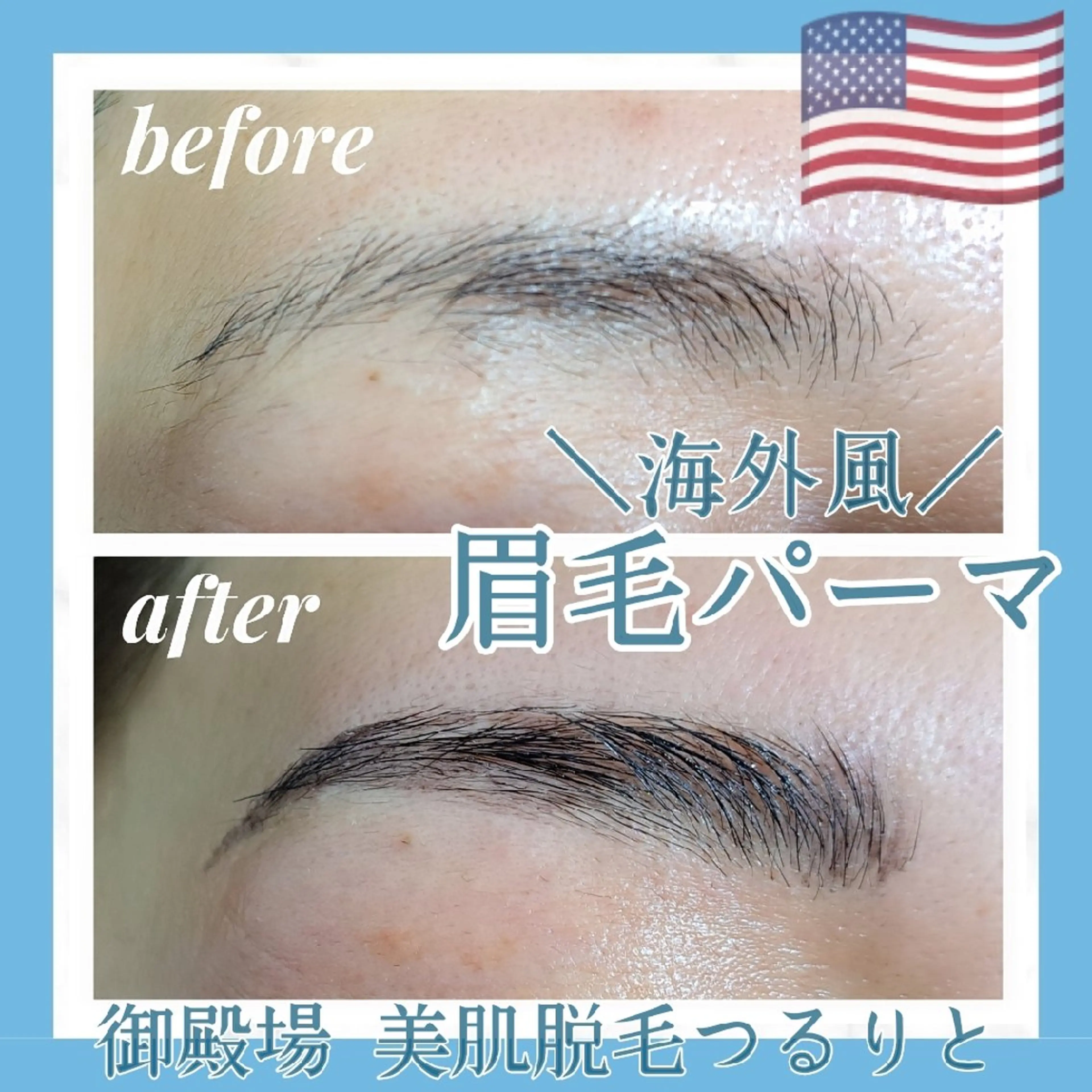 アイブロウ 眉毛ワックス脱毛 美肌脱毛サロン つるりと御殿場店所属・美肌脱毛サロン つるりとのその他イメージ