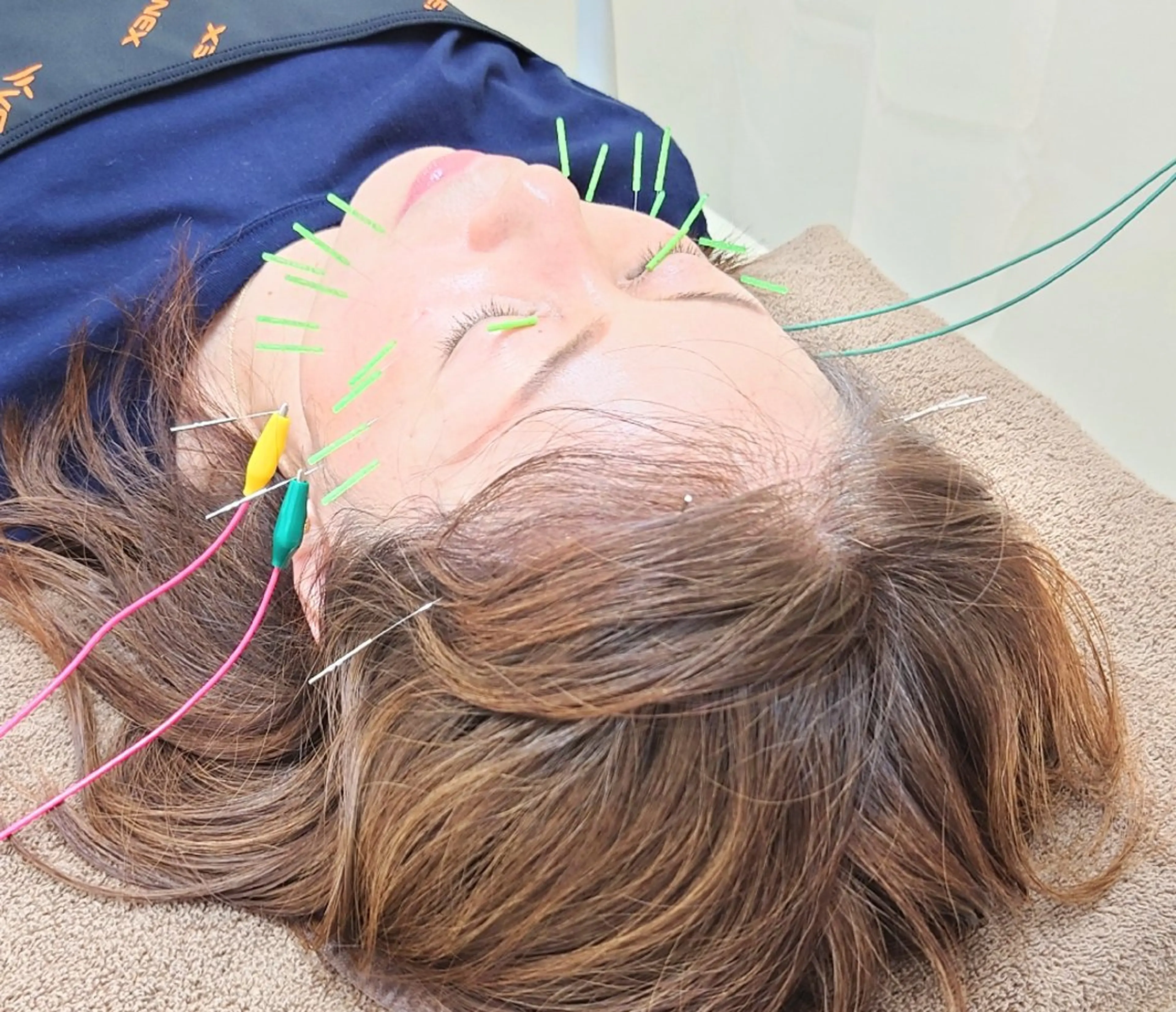 スカイブルー 鍼灸接骨院　佐々木のエステ・リラクイメージ