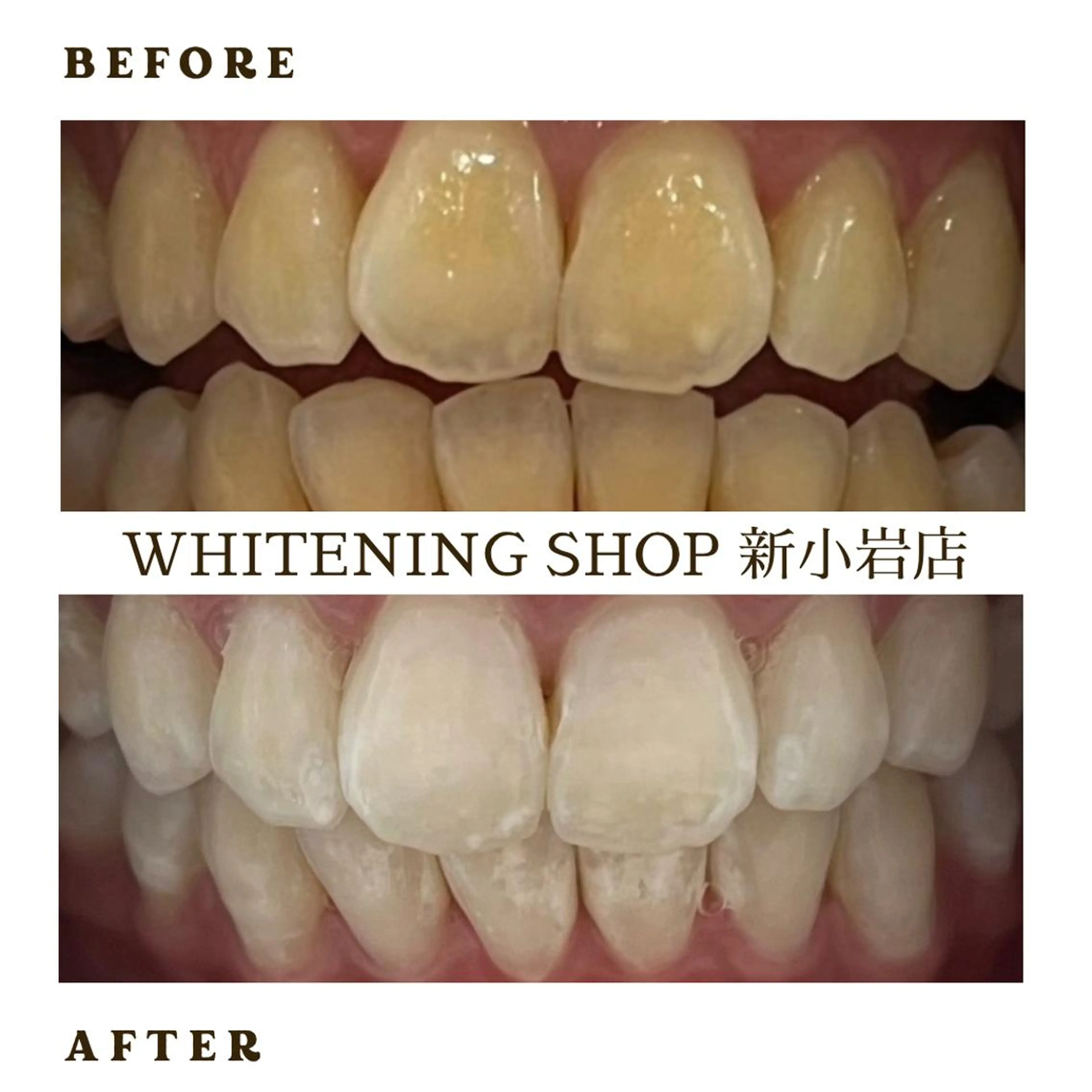 メンズ その他 ホワイトニング ショップ新小岩店のその他イメージ