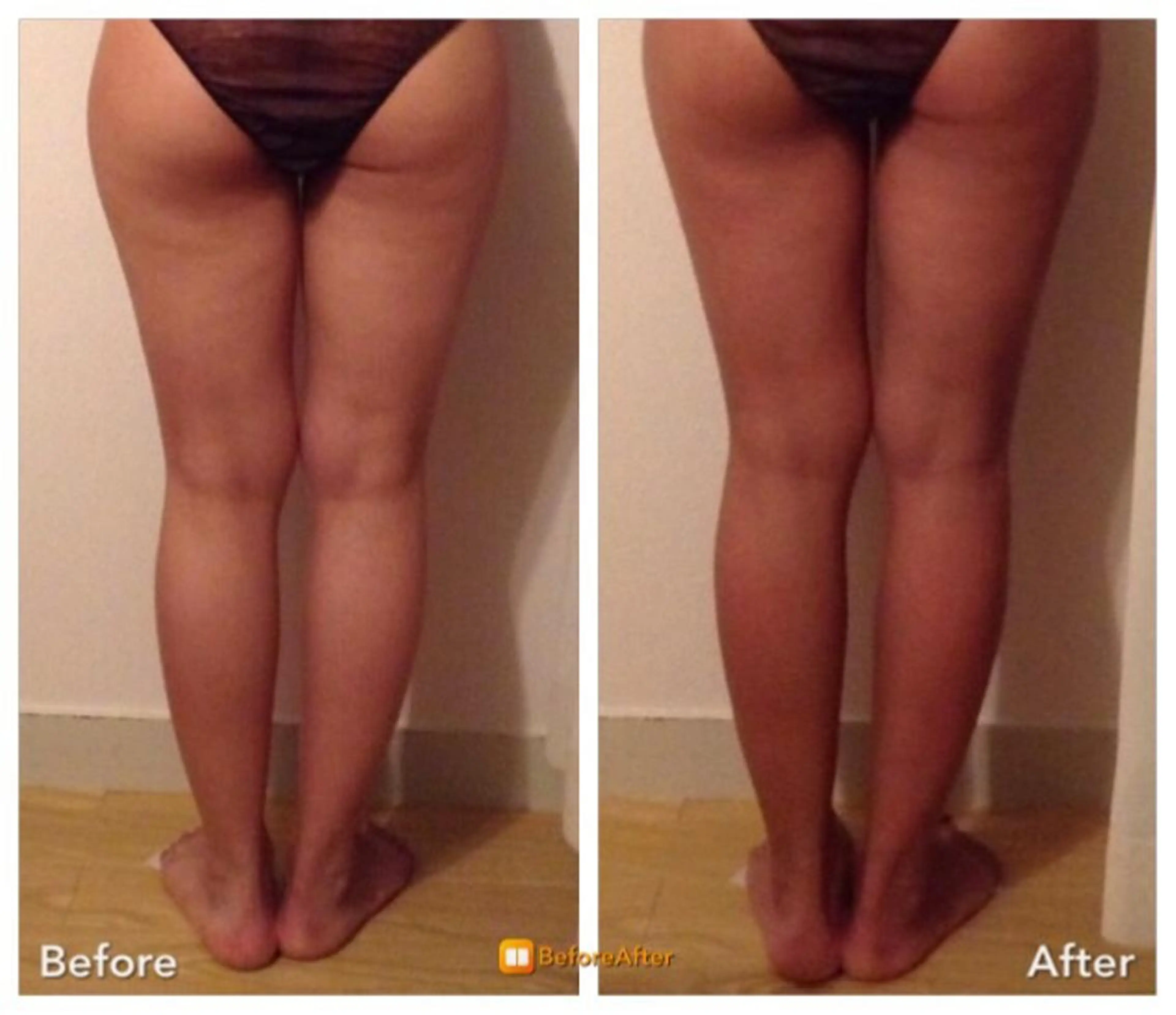 小尻・太もも痩せる エステルナボーテのエステ・リラクイメージ