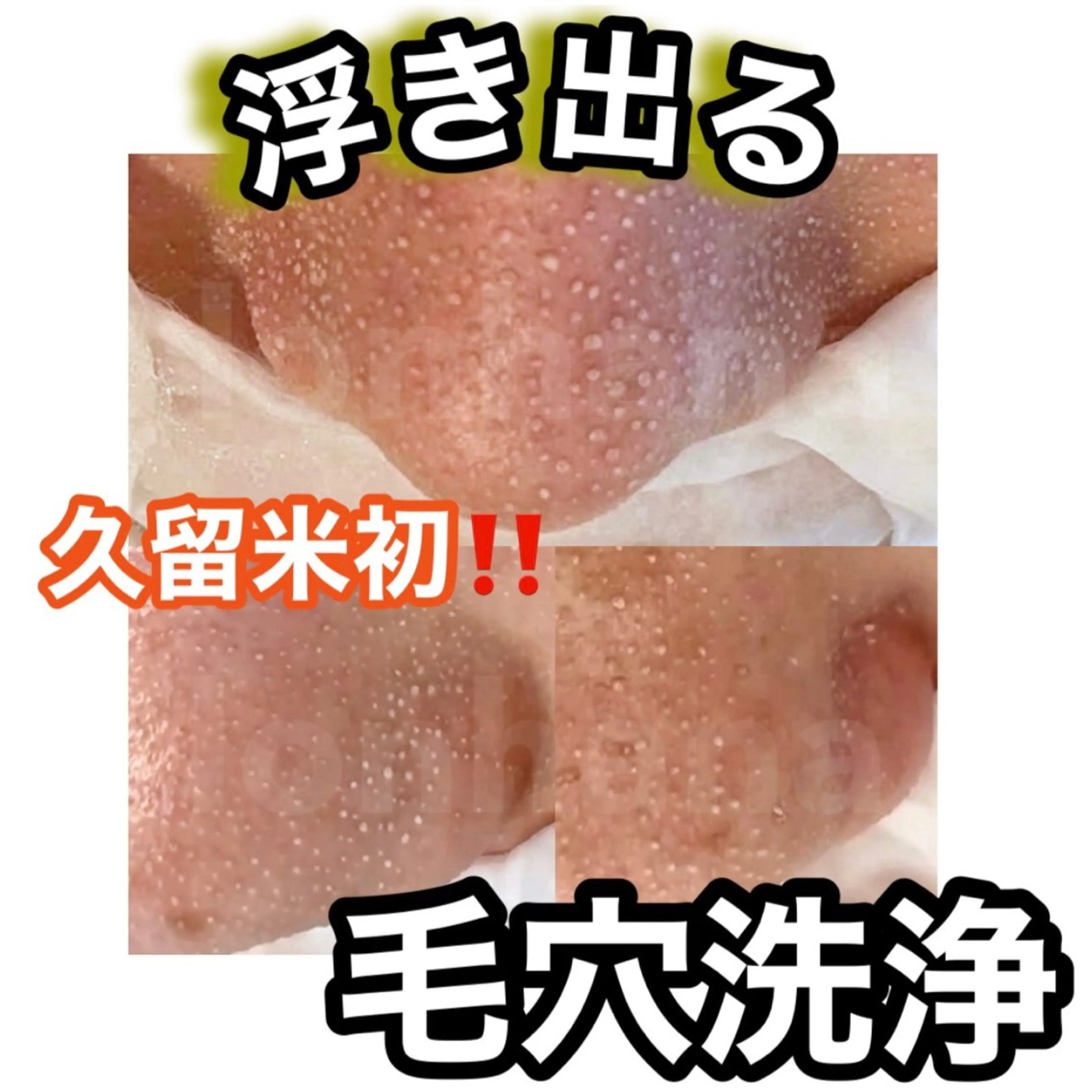 【極上たまご肌】韓国式3D毛穴洗浄  15400円→7200円 メンズも◎の写真