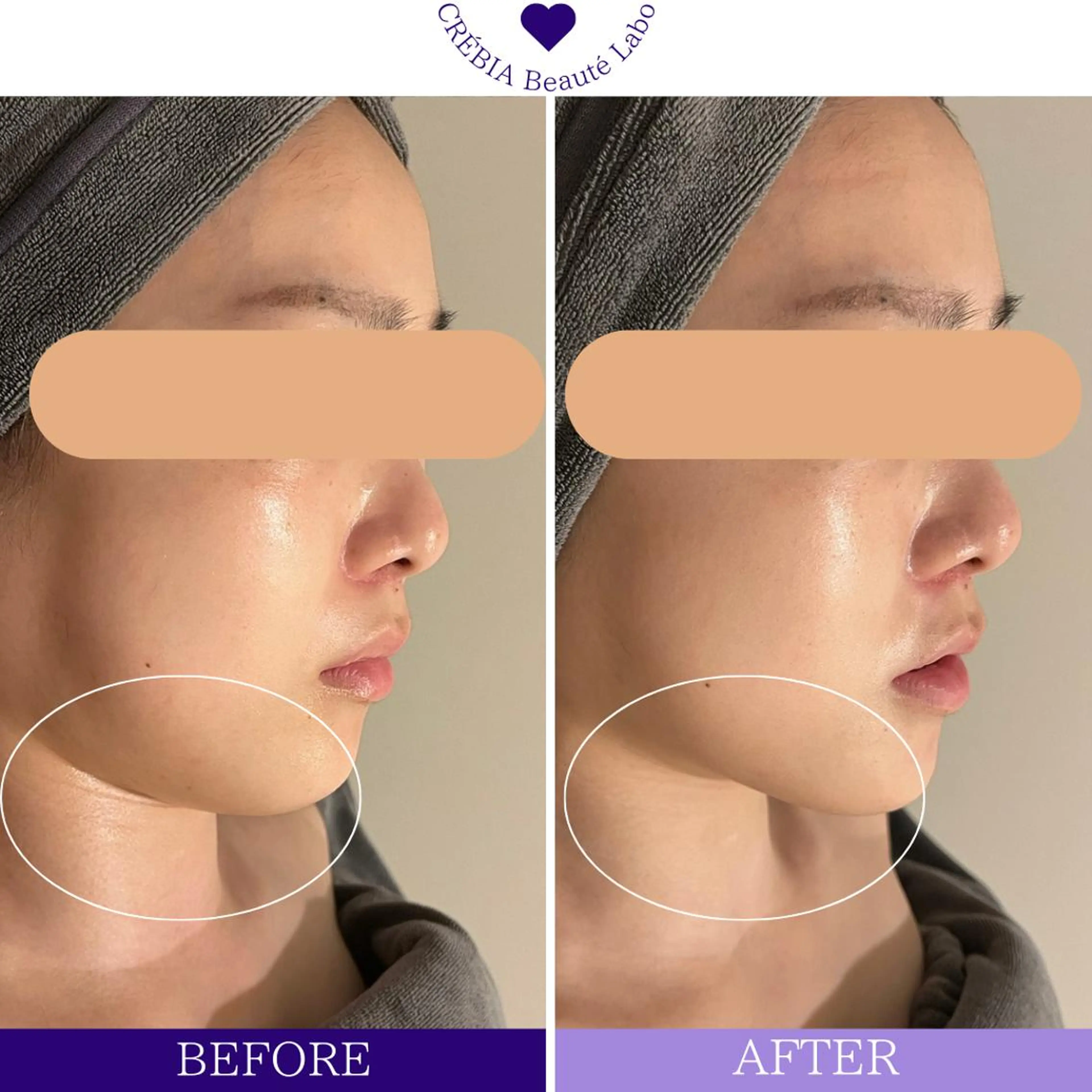 エステ リラク 小顔＆まつ毛サロン AKANE❤️のエステ・リラクイメージ