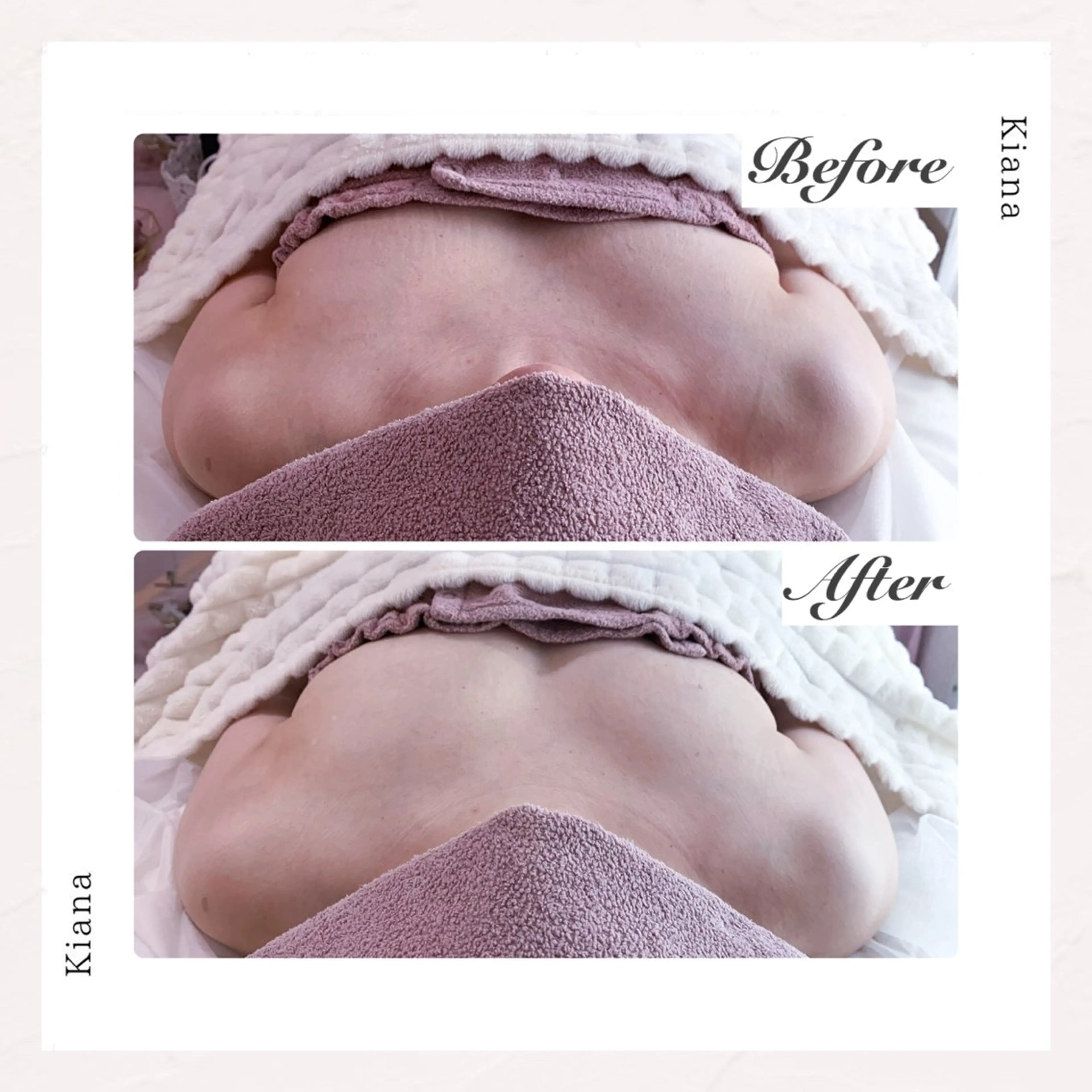 バスト専門Kiana 風のエステ・リラクイメージ