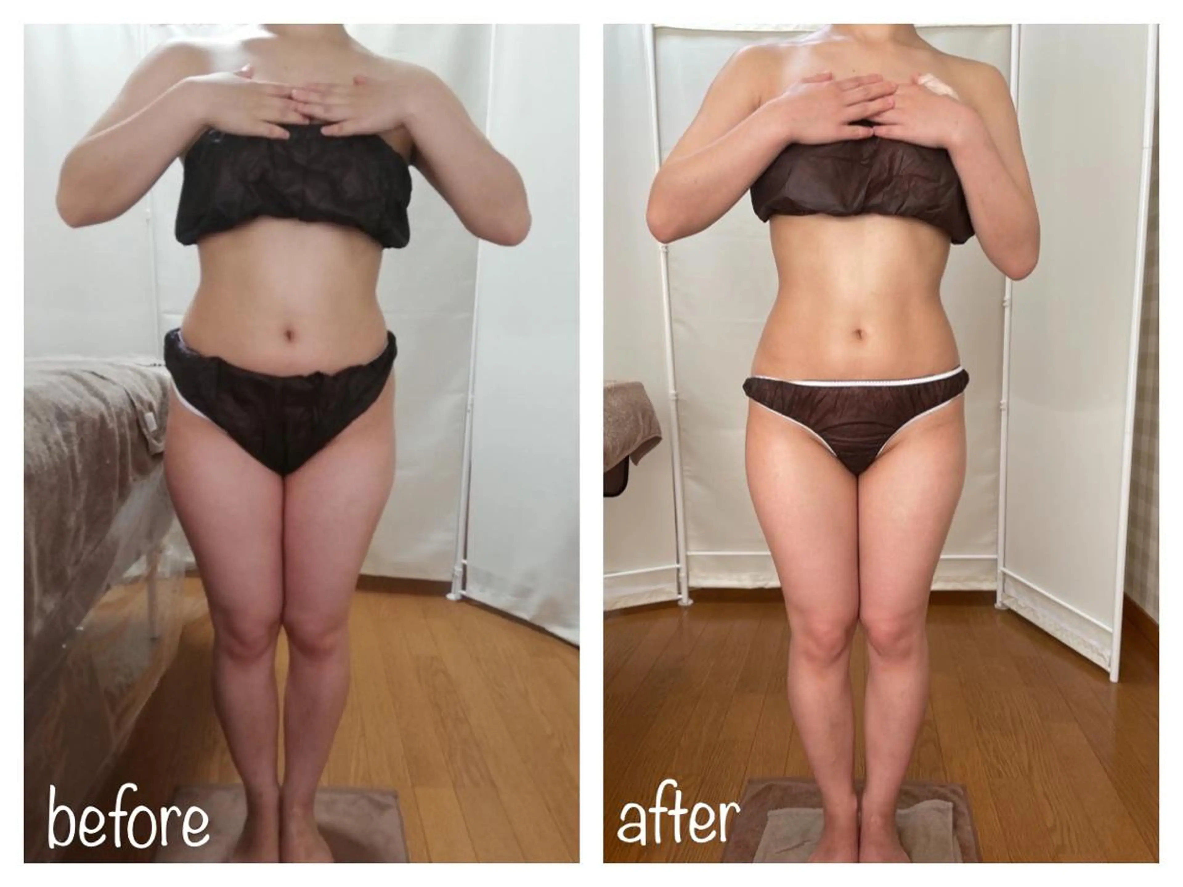 biloop所属・《痩身×疲労改善》 BILOOPのエステ・リラクイメージ