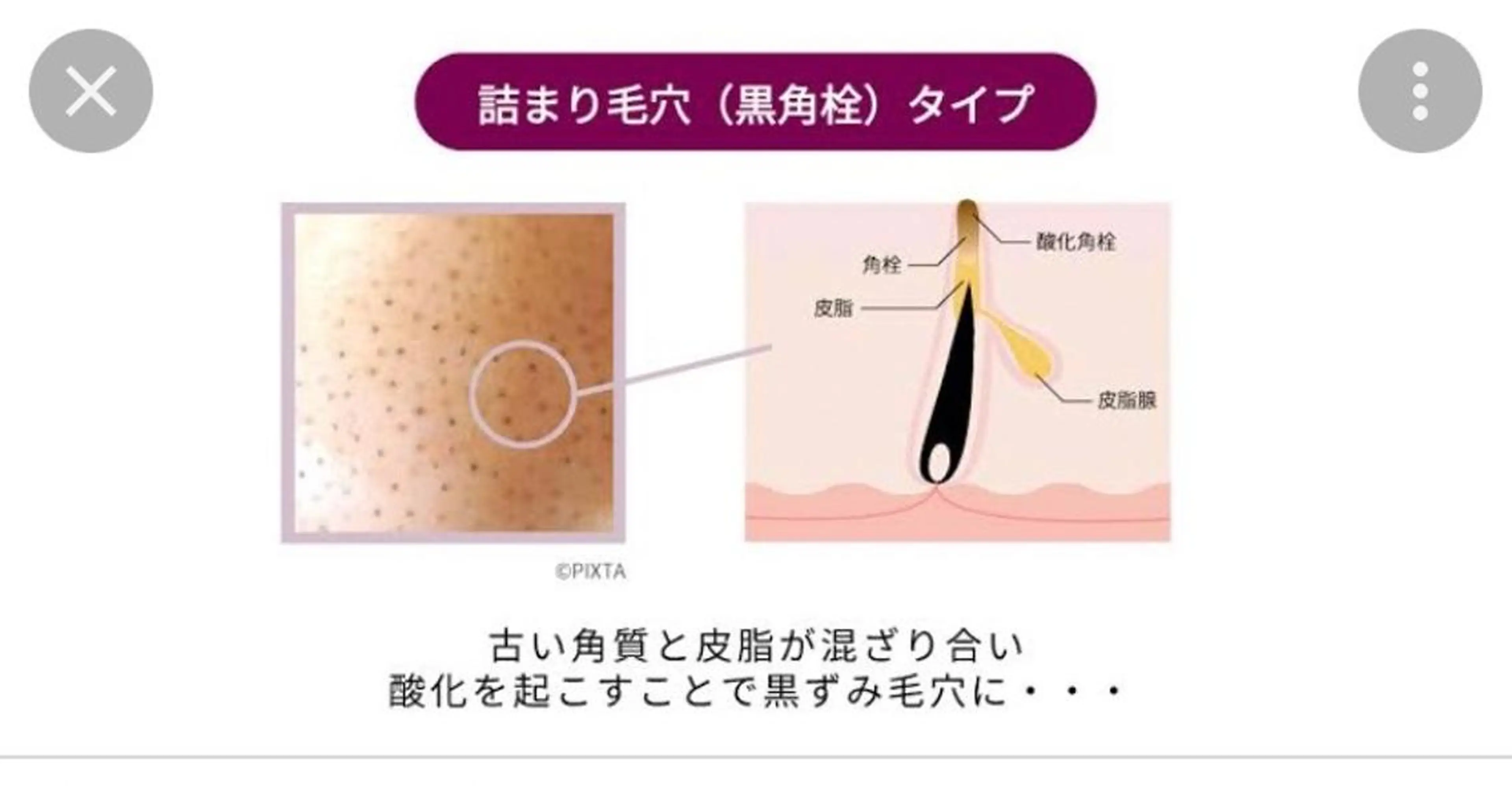 夏までに肌荒れ卒業 するサロン🌻のエステ・リラクイメージ