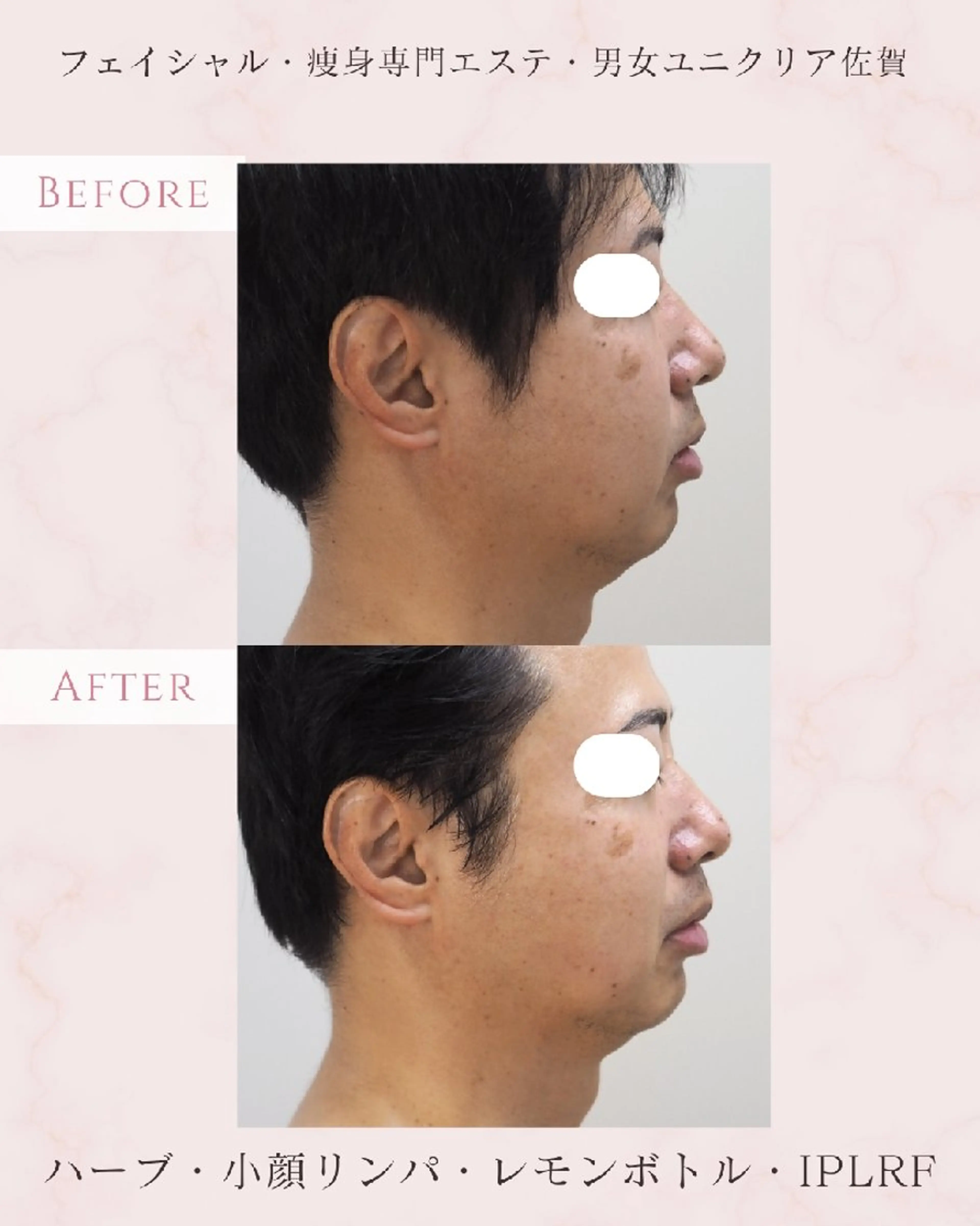 メンズ ユニセックスエステサロンUniclear所属・痩身&フェイシャル Uniclearのエステ・リラクイメージ