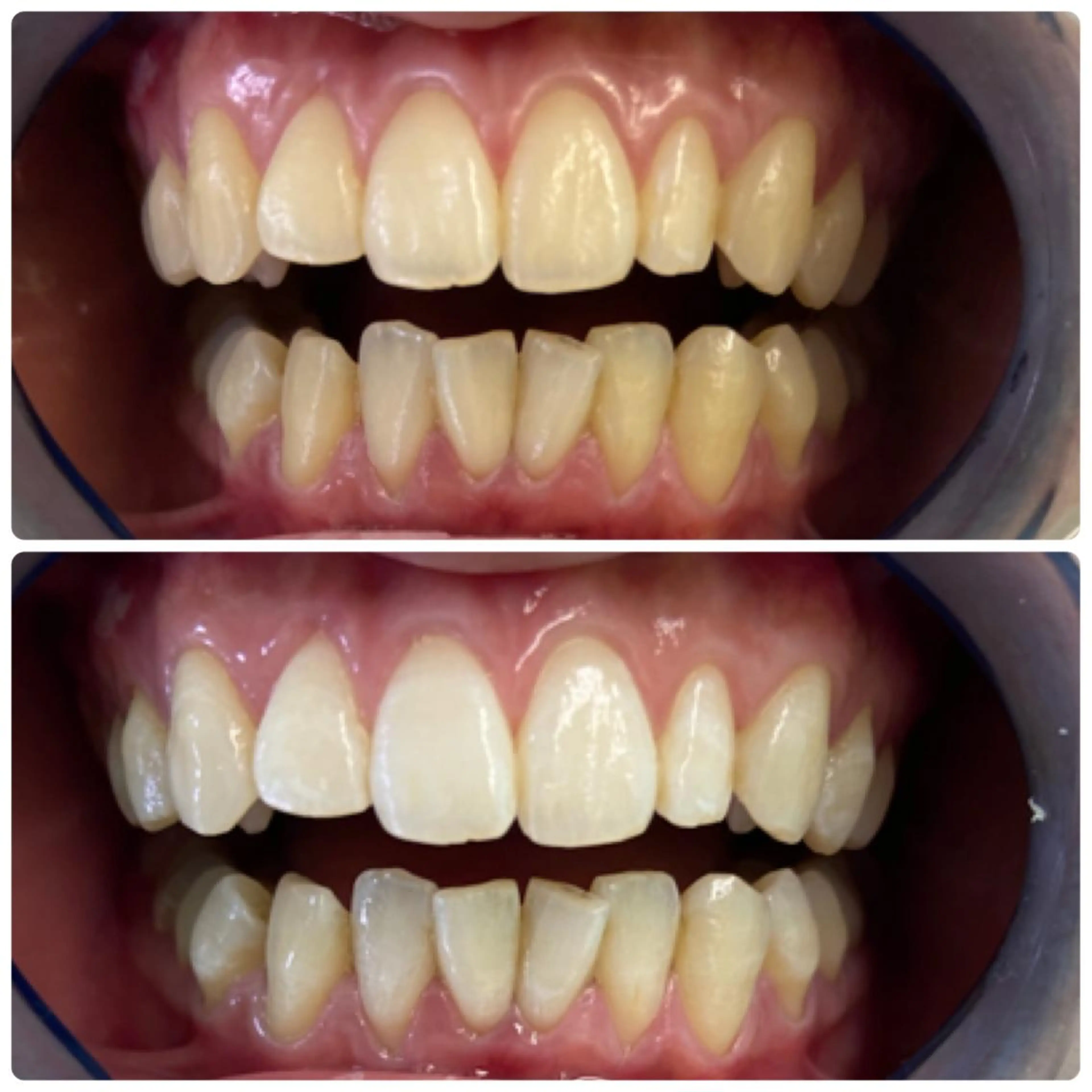 その他 PLATINUM Beauty 横浜店所属・ホワイトニングルーム 横浜店のその他イメージ