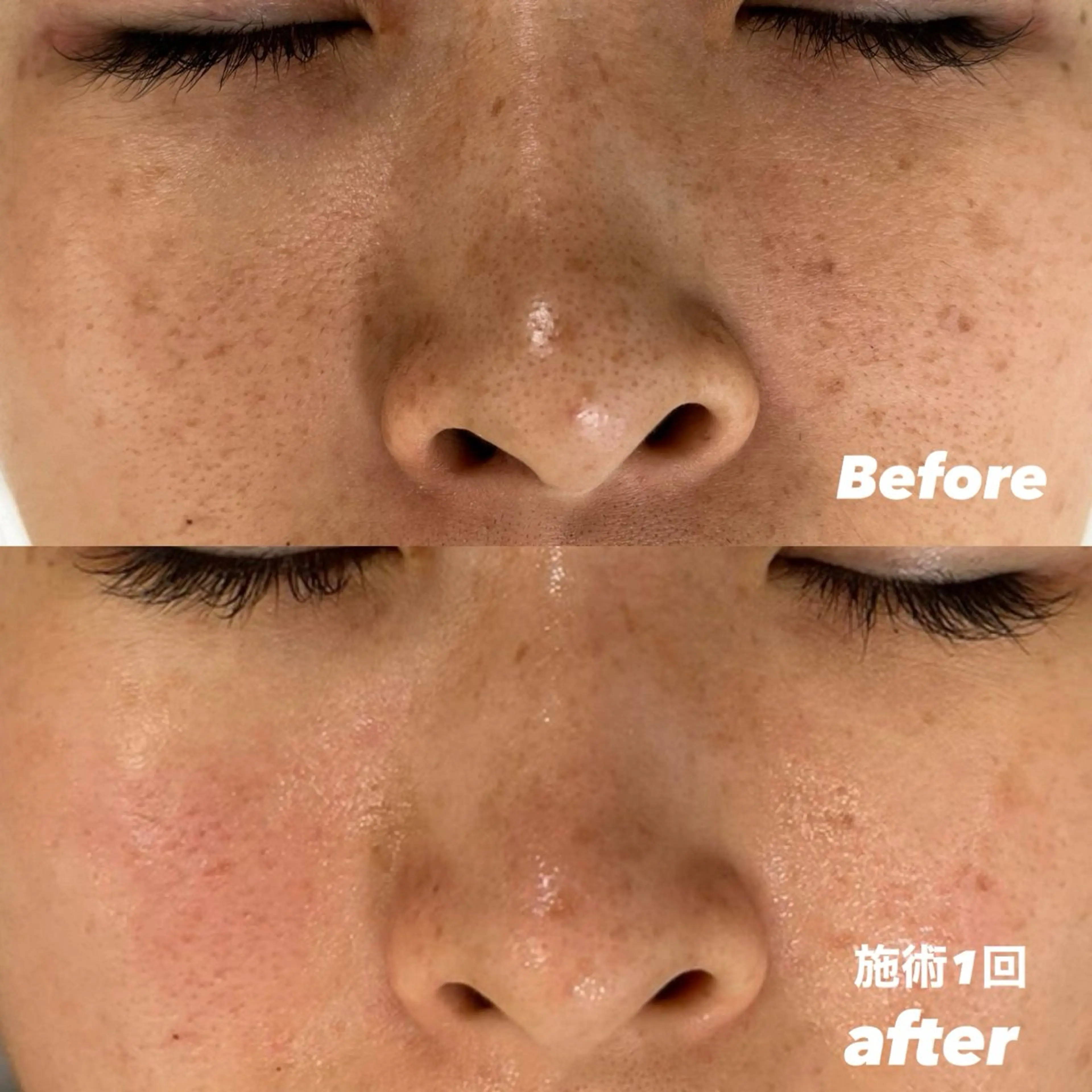 エステ 豊田 明里のエステ・リラクイメージ