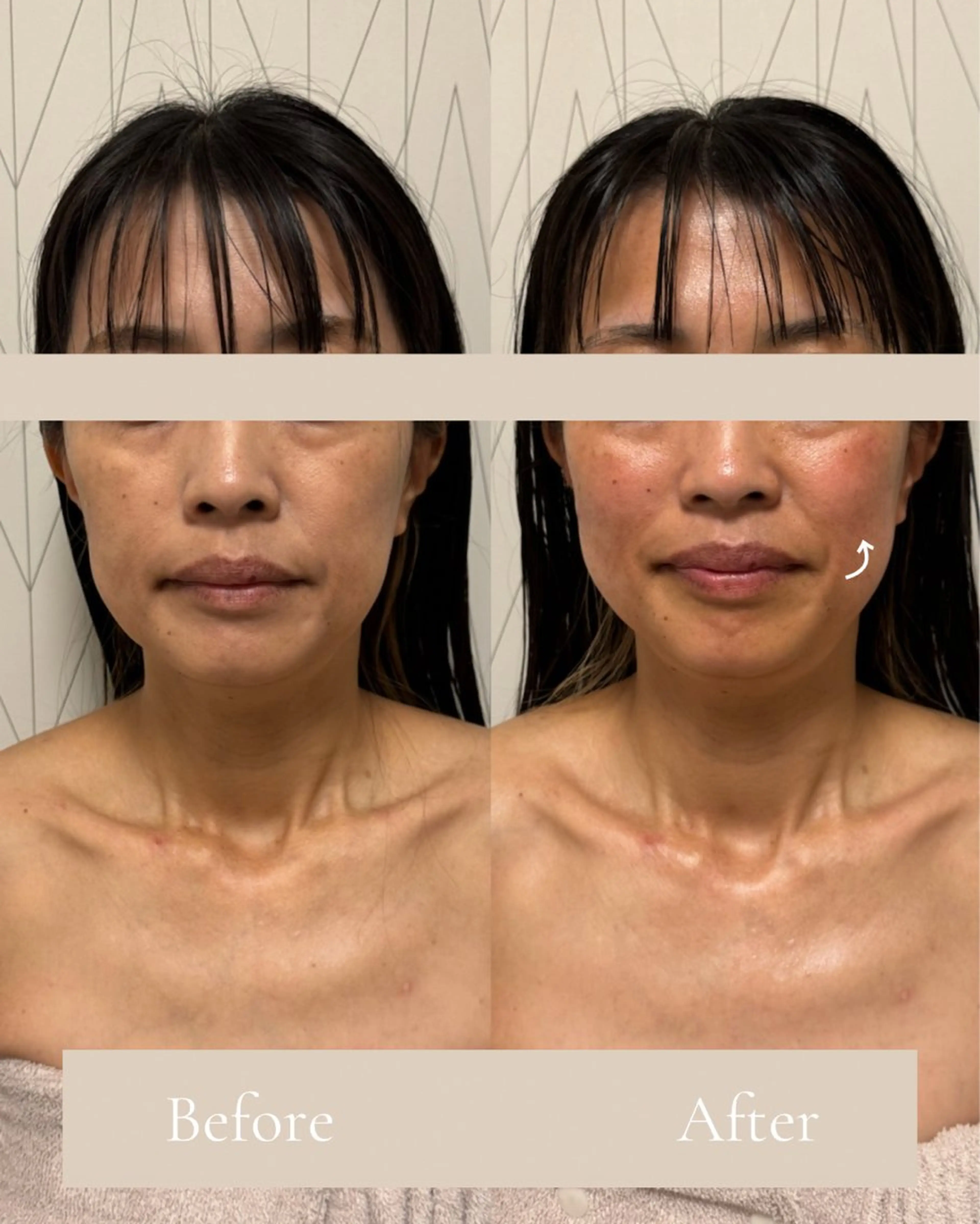 Lani Moon所属・⟡ 京都 小顔  ⊹ Lani Moonのエステ・リラクイメージ