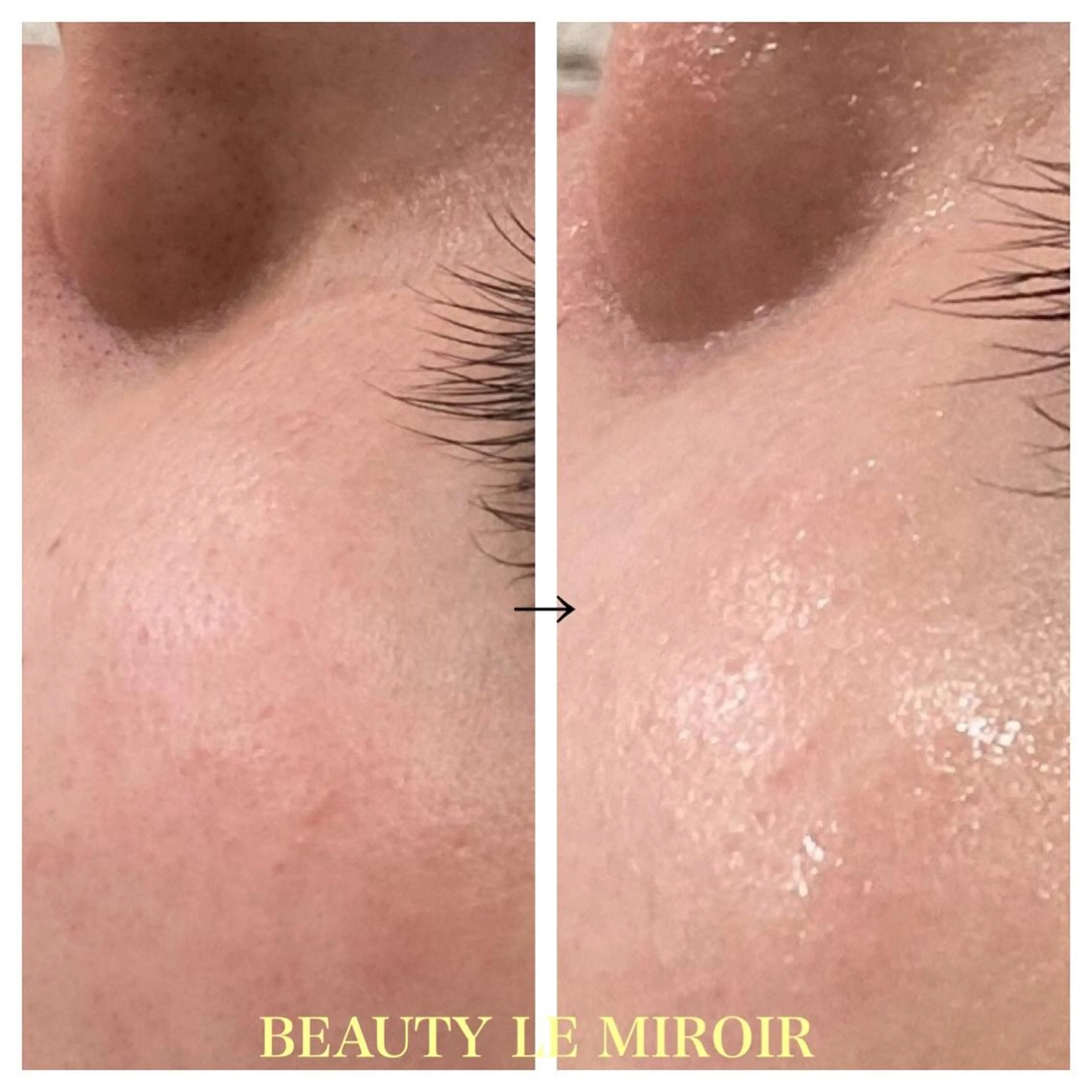 ビューティー ミロワールのエステ・リラクイメージ