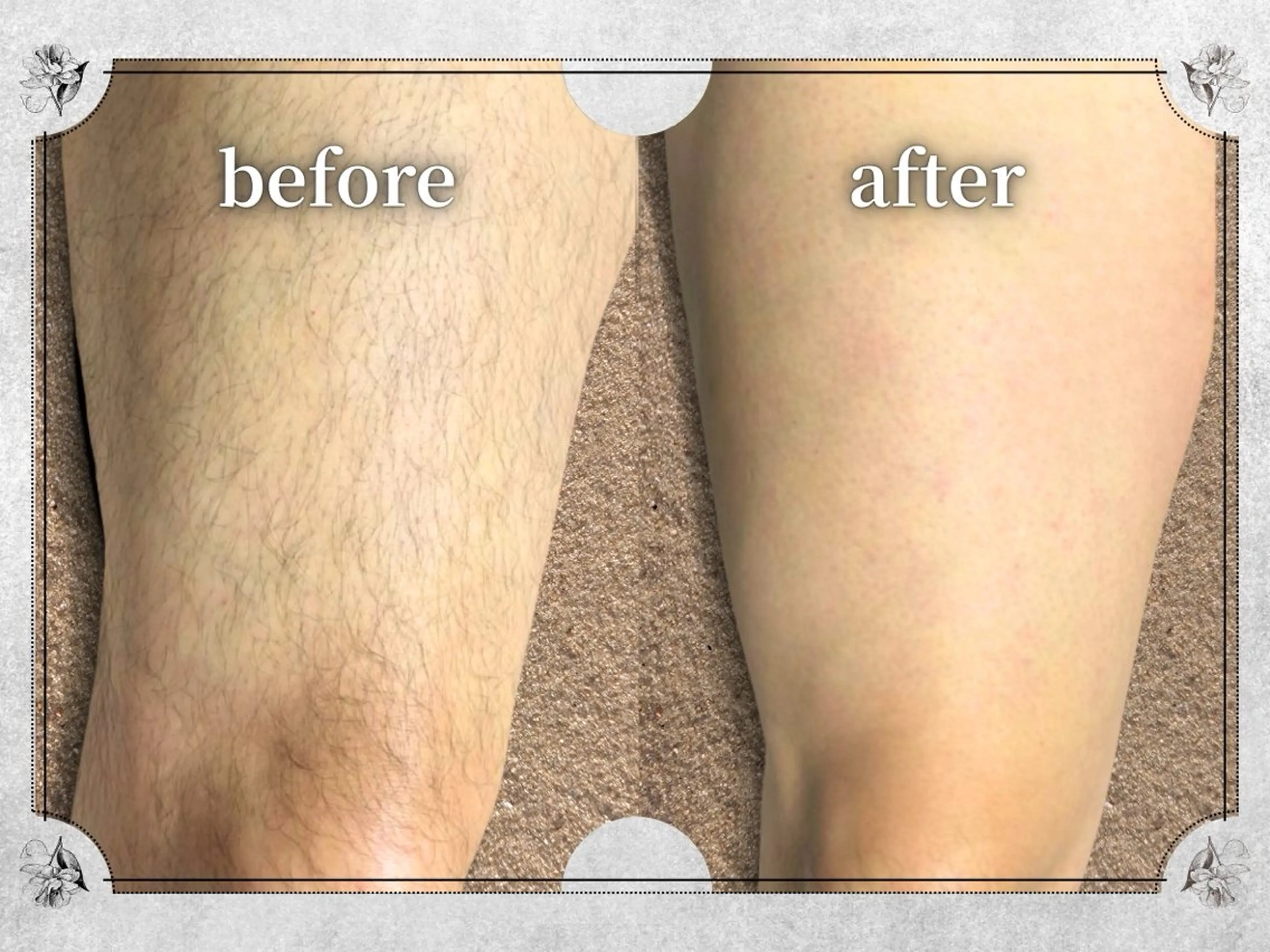 Lino by MIRA/Yuinaのエステ・リラクイメージ