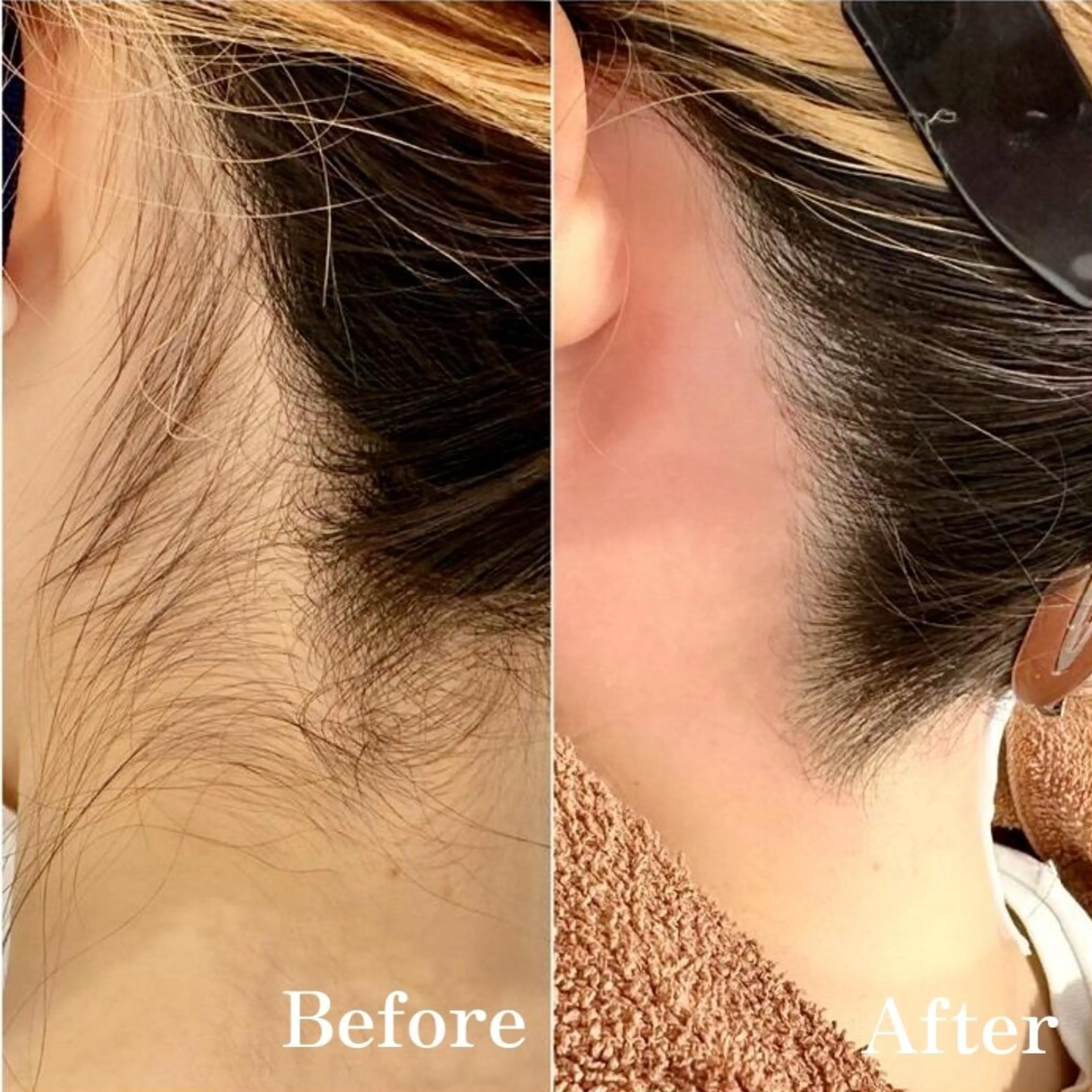 【女性限定】うなじWAXの写真