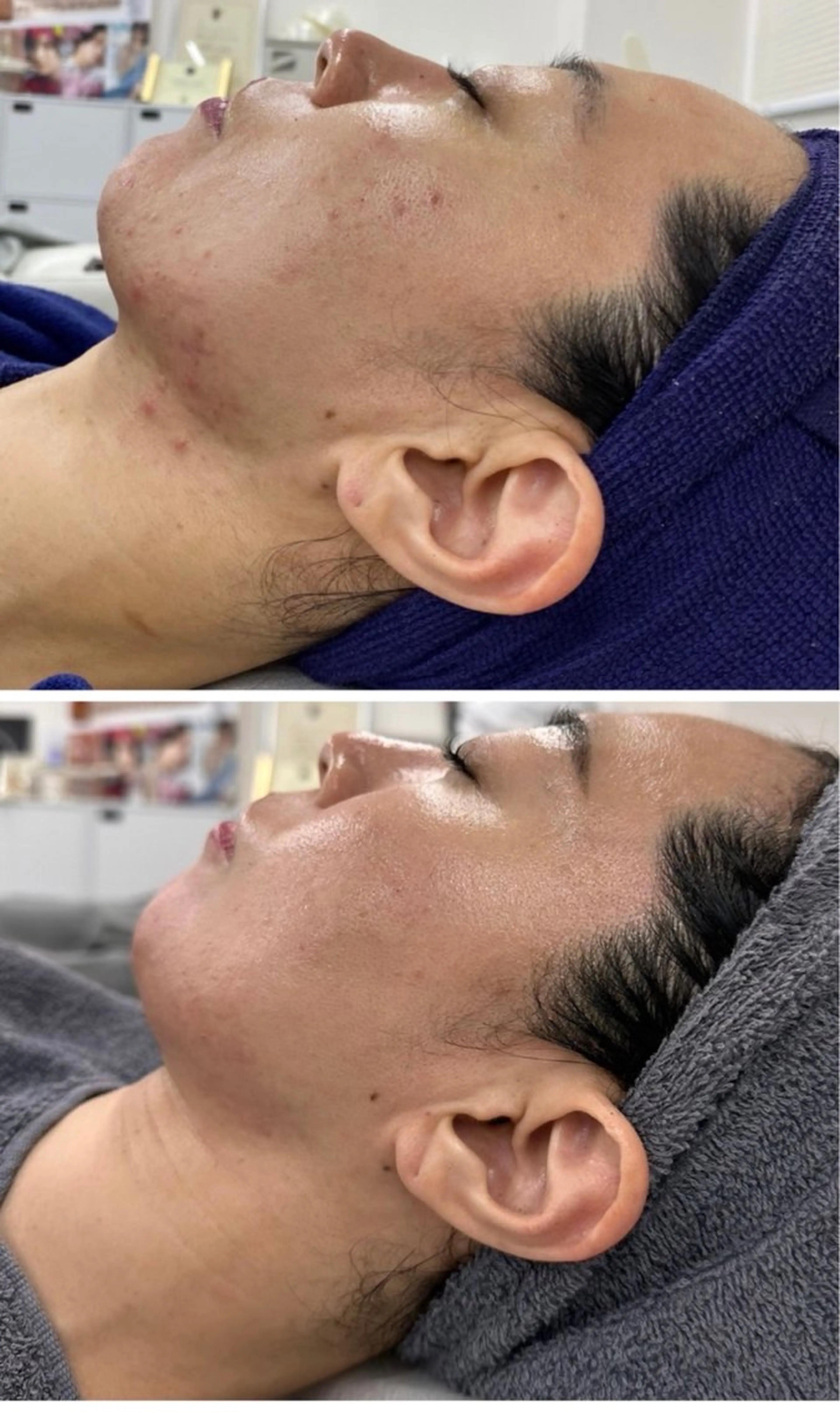 M.plus所属・水光韓国肌ハーブ ピーリングMplusのエステ・リラクイメージ