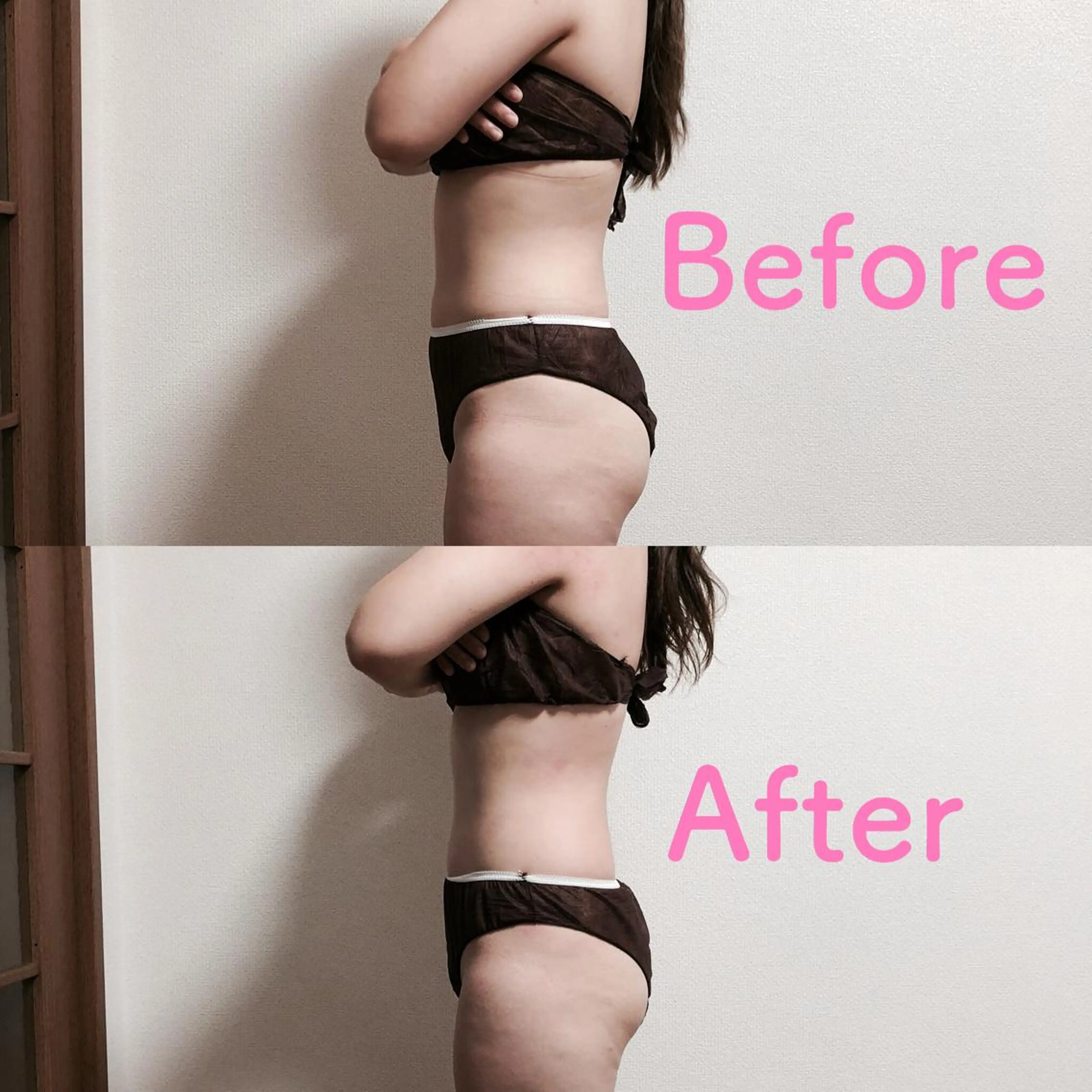 キャビテーション＋ラジオ波＋吸引＋EMS＋LED 複合機痩身ダイエット 4カ所の写真