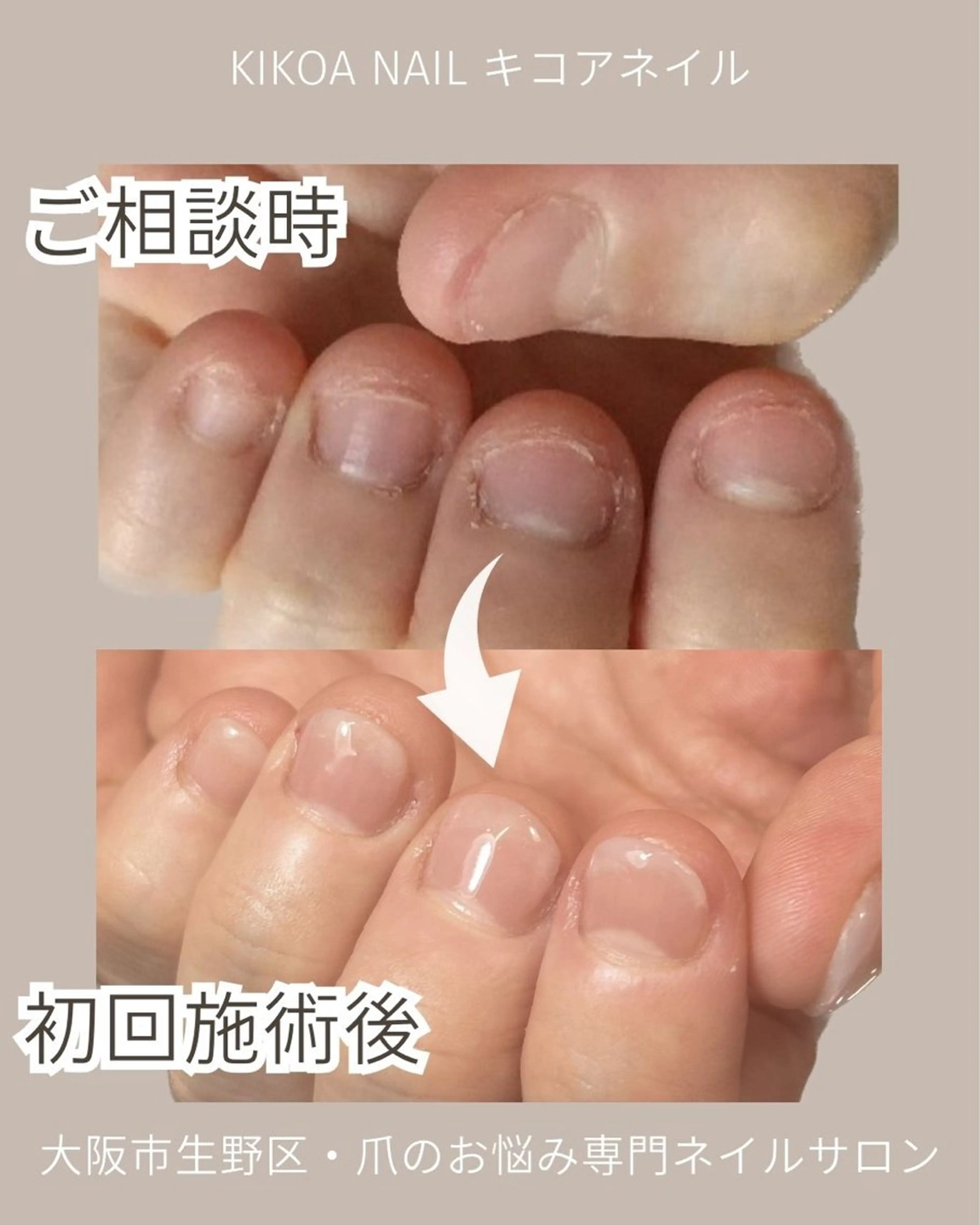 ネイル KIKOA NAIL キコアネイルのネイルデザイン