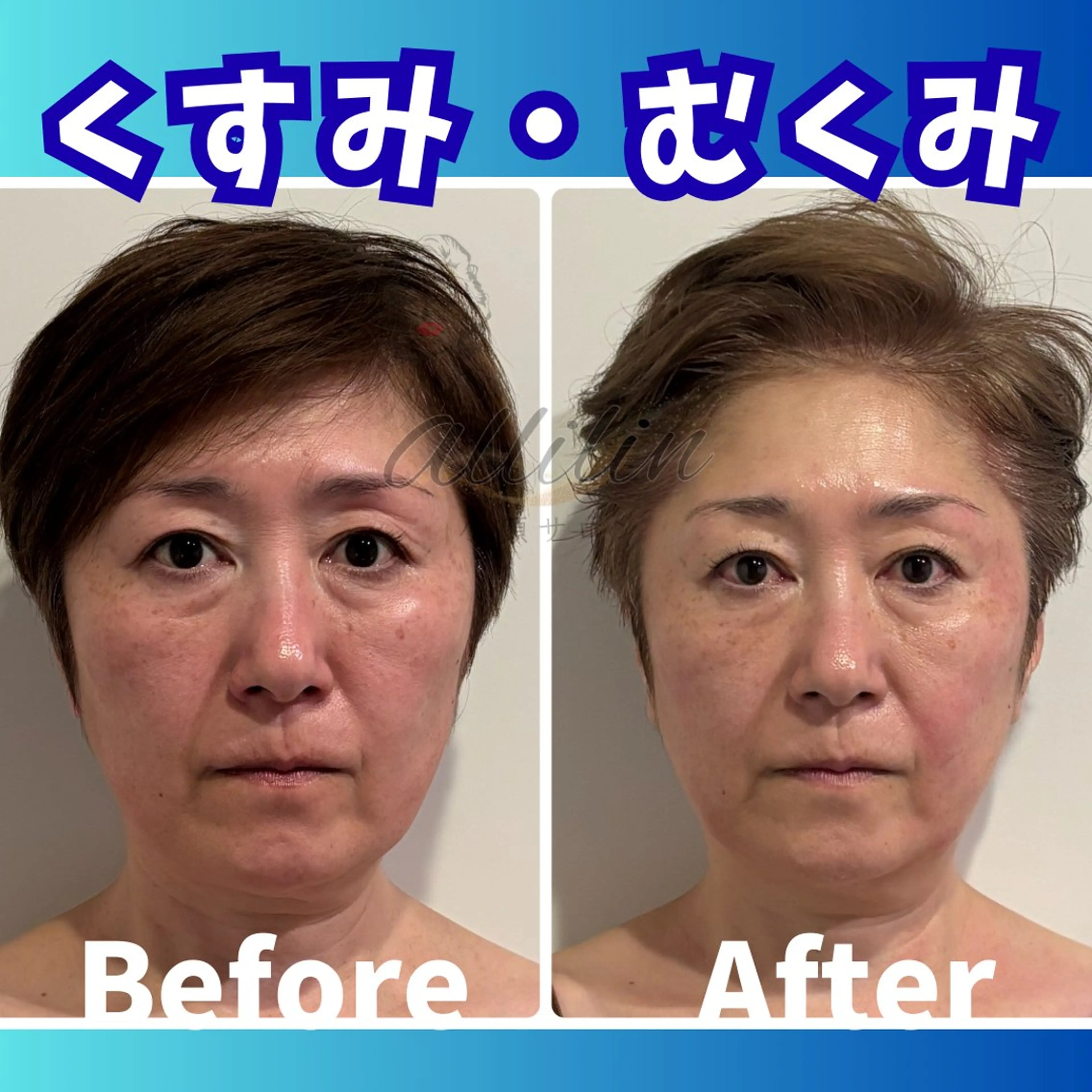 エステ 💎小顔サロン アリリン銀座💎のエステ・リラクイメージ