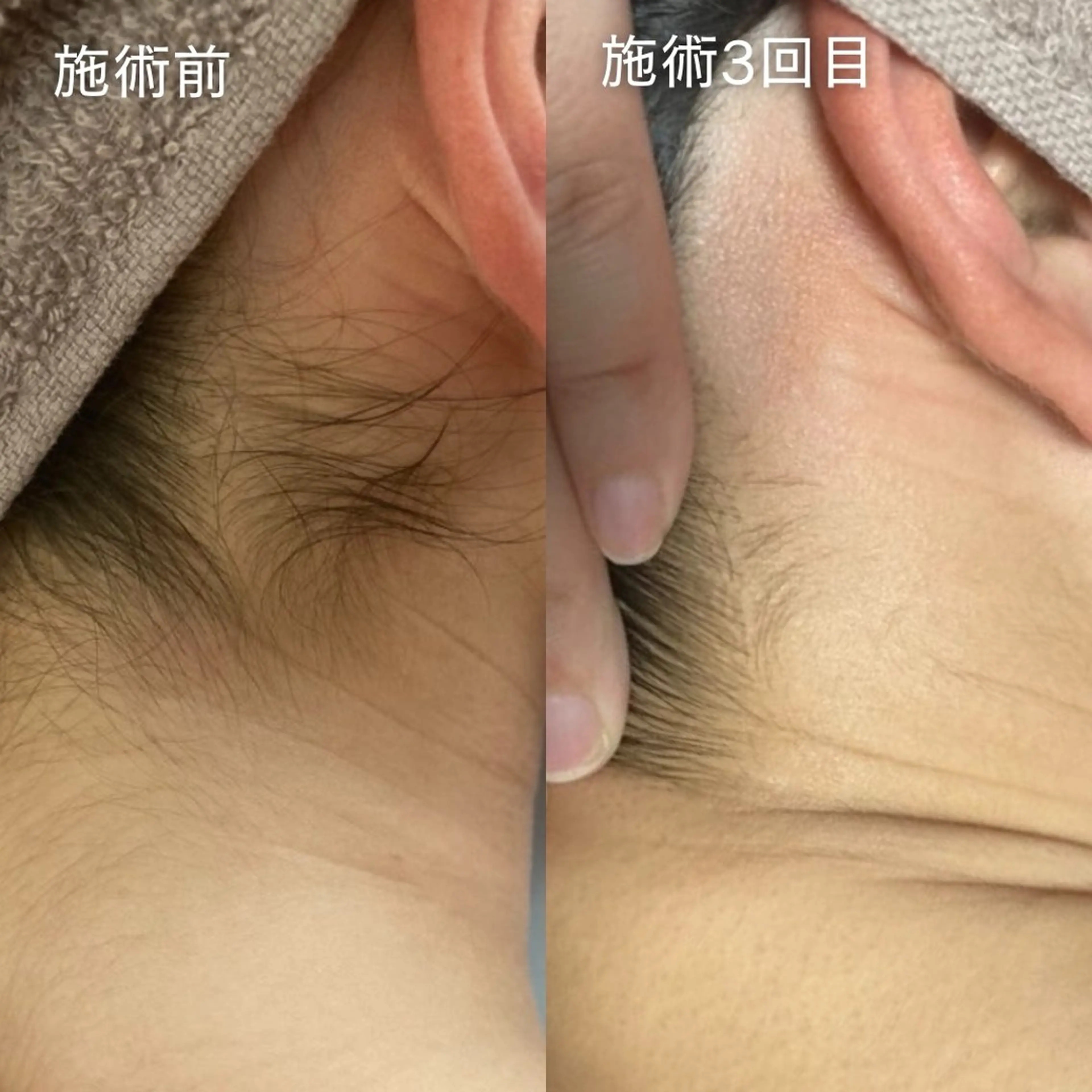 脱毛 OWL TOTAL BEAUTY SALON所属・OWL 脱毛&バストケアのその他イメージ