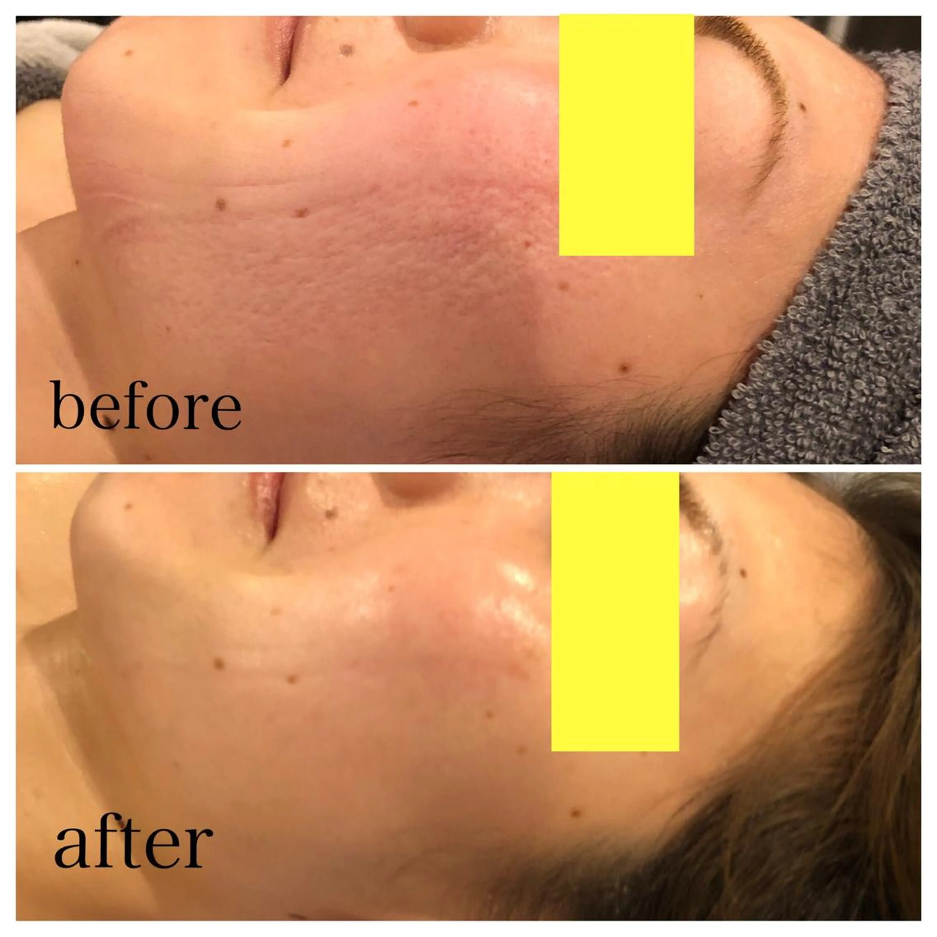 ミディアム カラー パーマ ヘアアレンジ メンズ ネイル マツエク・マツパ アイブロウ 赤色 SALON SINCERITEのエステ・リラクイメージ