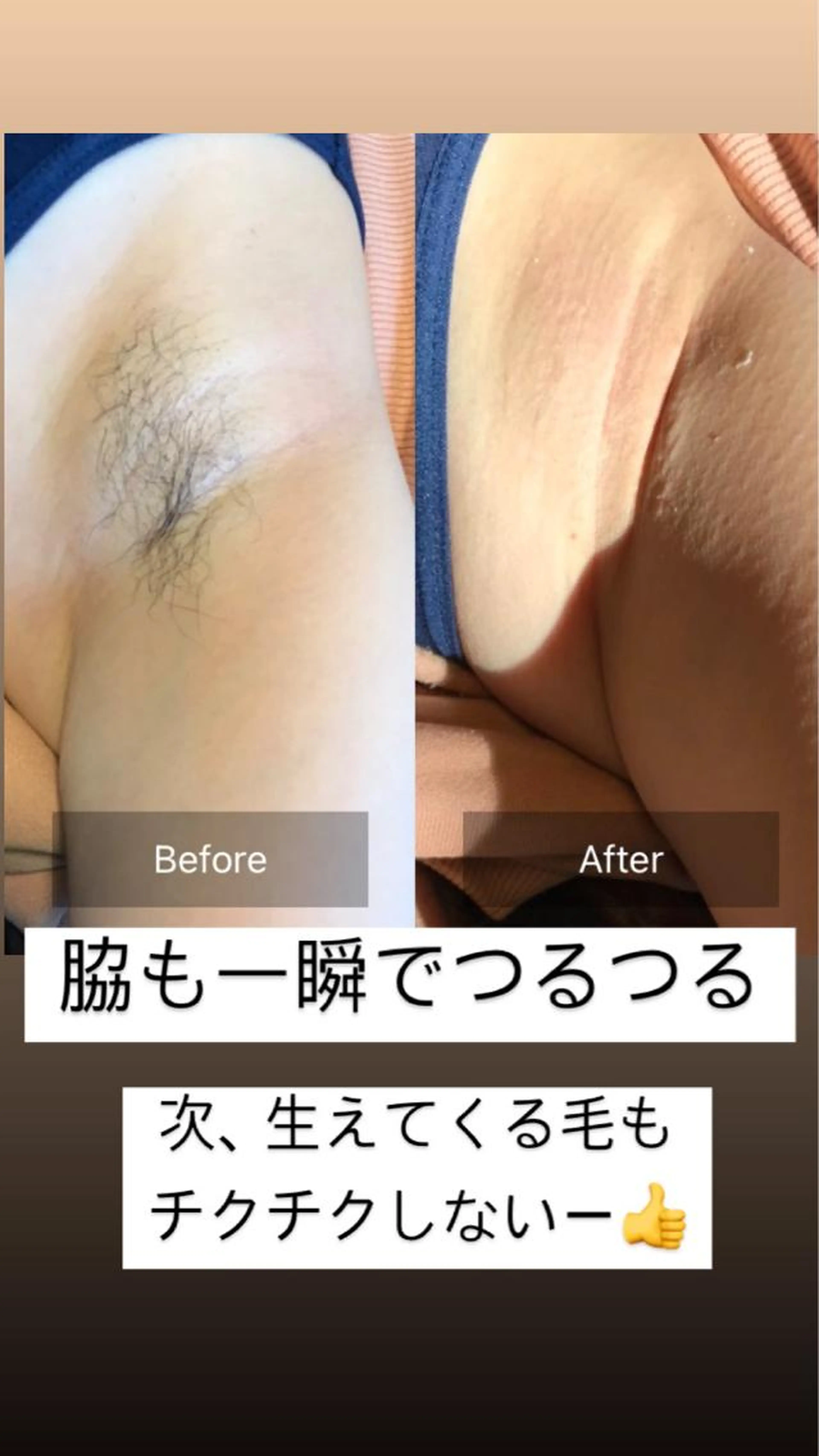 脇ワックスの写真