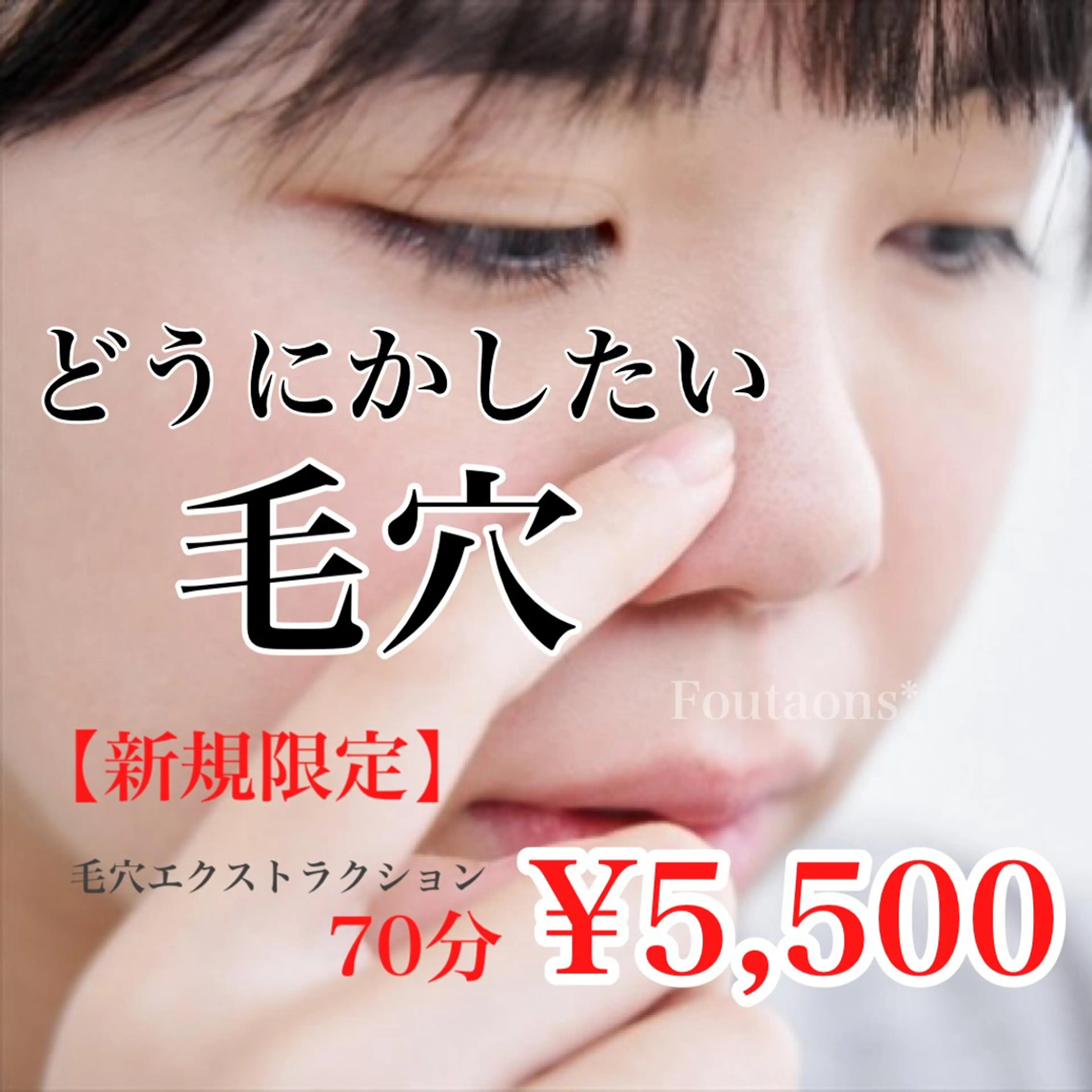 ❤️初回限定❤️何しても改善しなかった…毛穴でお悩みの方必見✨男女ok✨【毛穴エクストラクション】70分の写真