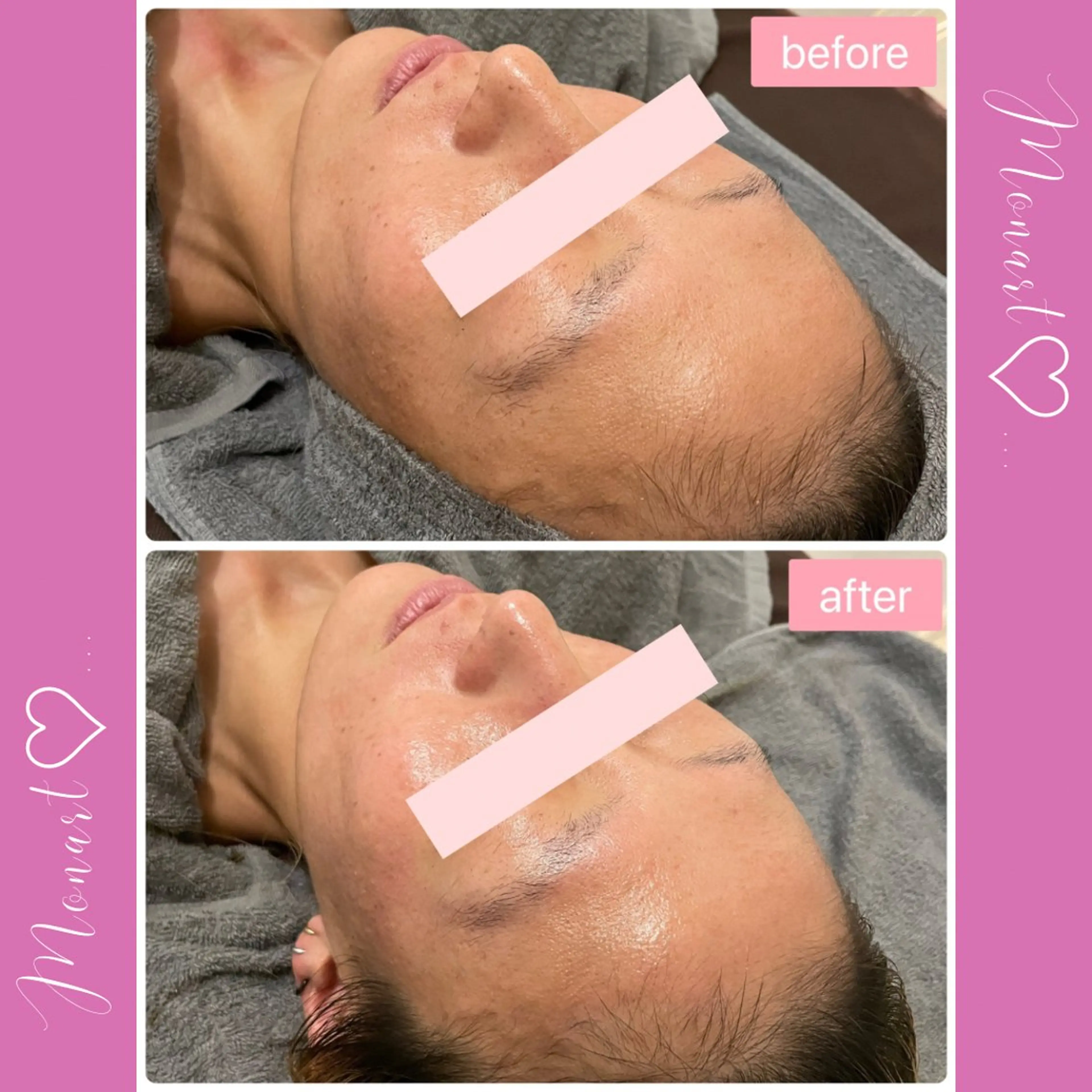 Monart -deux-のエステ・リラクイメージ