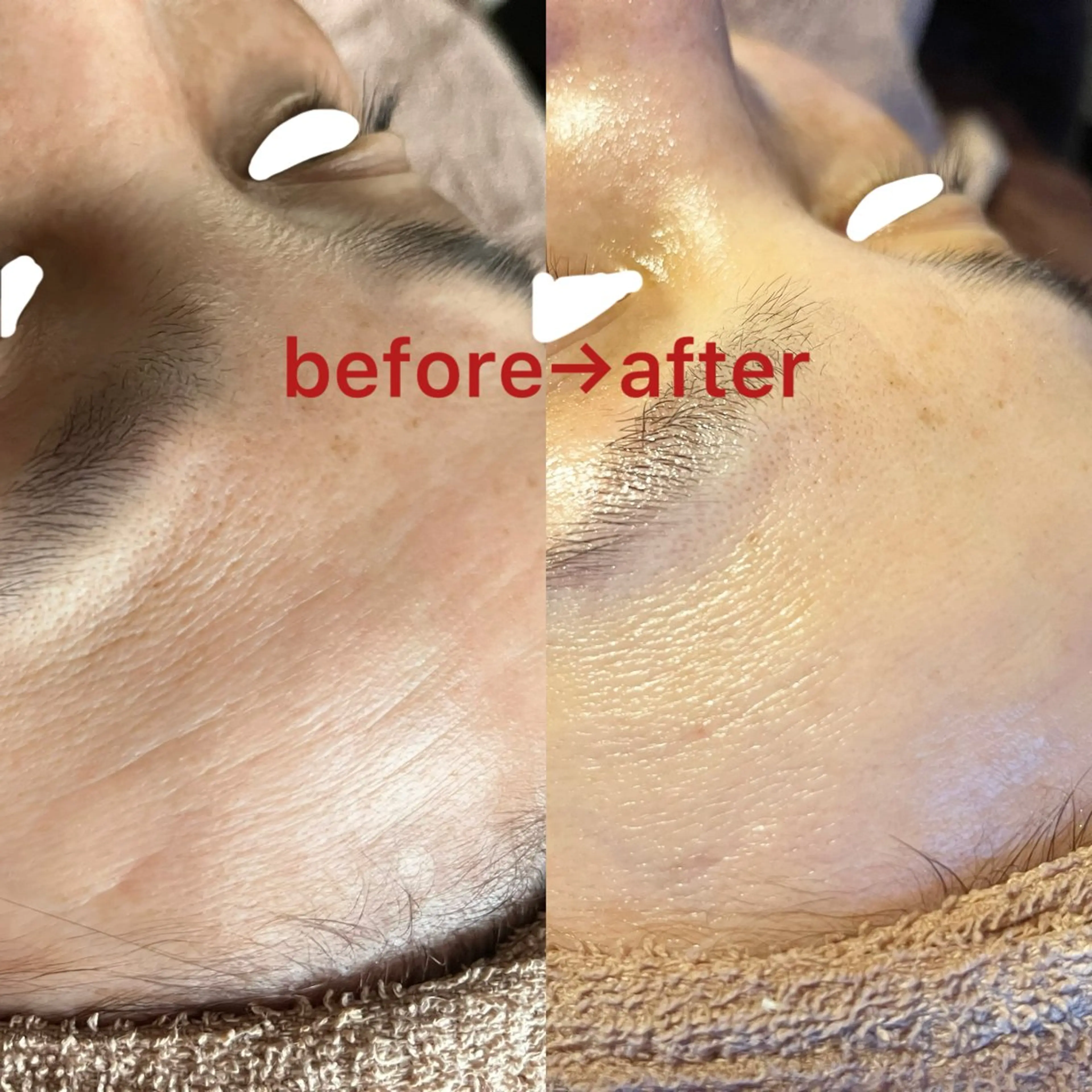 エステ La BeIIe vie所属・LaBeIIevie ラベルヴィのマツエク・マツパデザイン