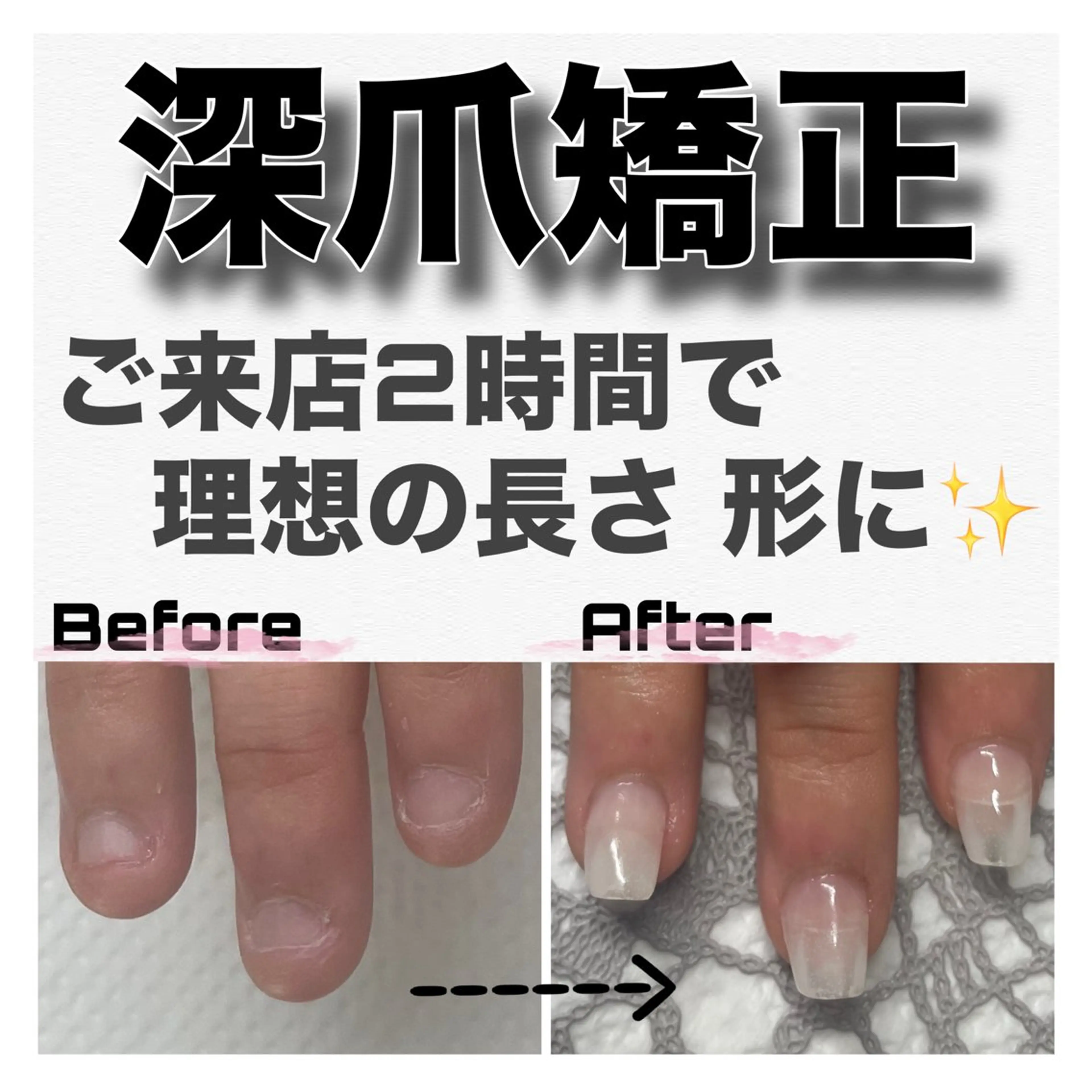 ネイル クリアネイル 長さ出し ジェルネイル ハンドネイル ハンドケア petillant所属・nail salon petillantのネイルデザイン