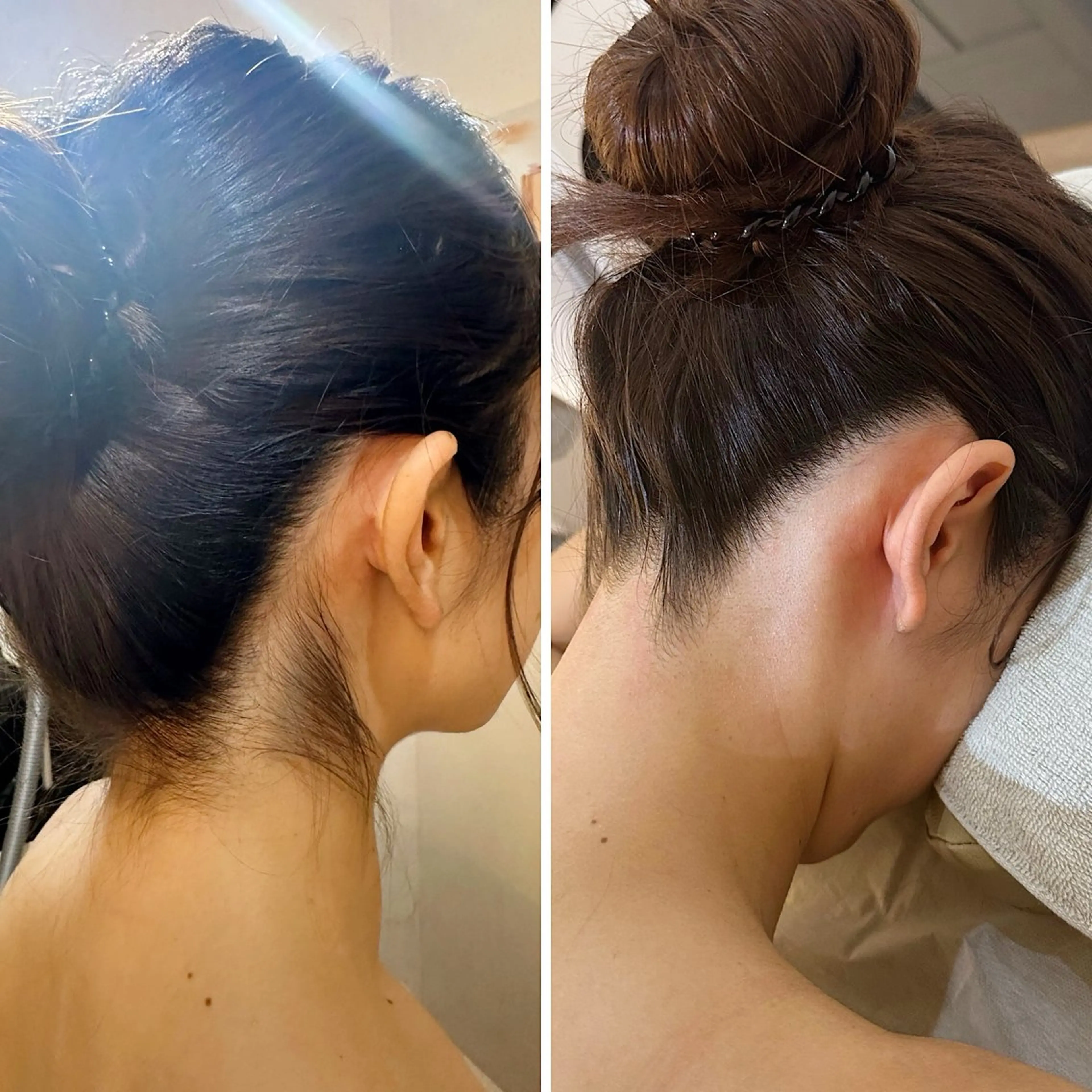 脱毛 うなじ脱毛/美肌脱毛 LABELのエステ・リラクイメージ