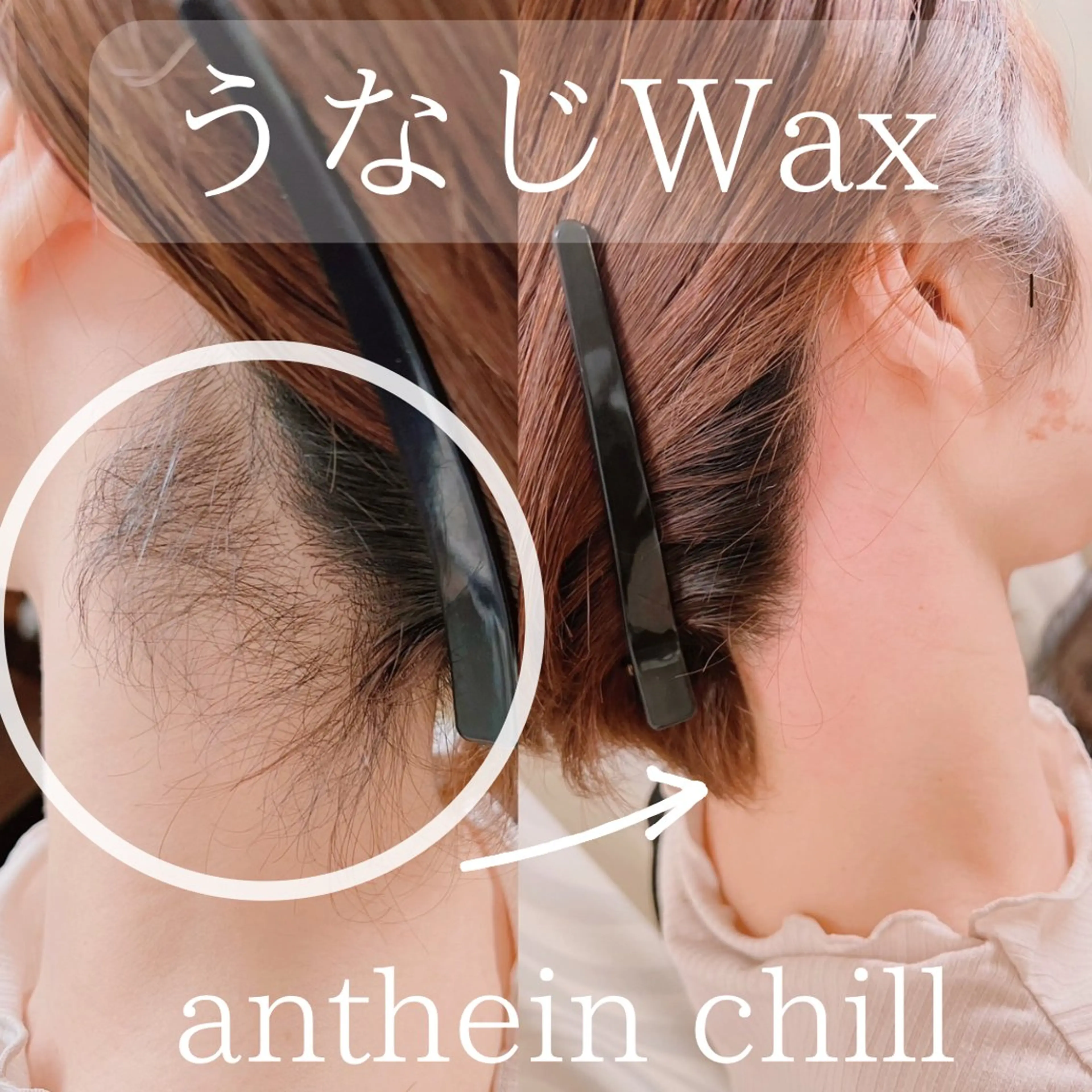 夏におすすめ✨【うなじWax脱毛✨】の写真