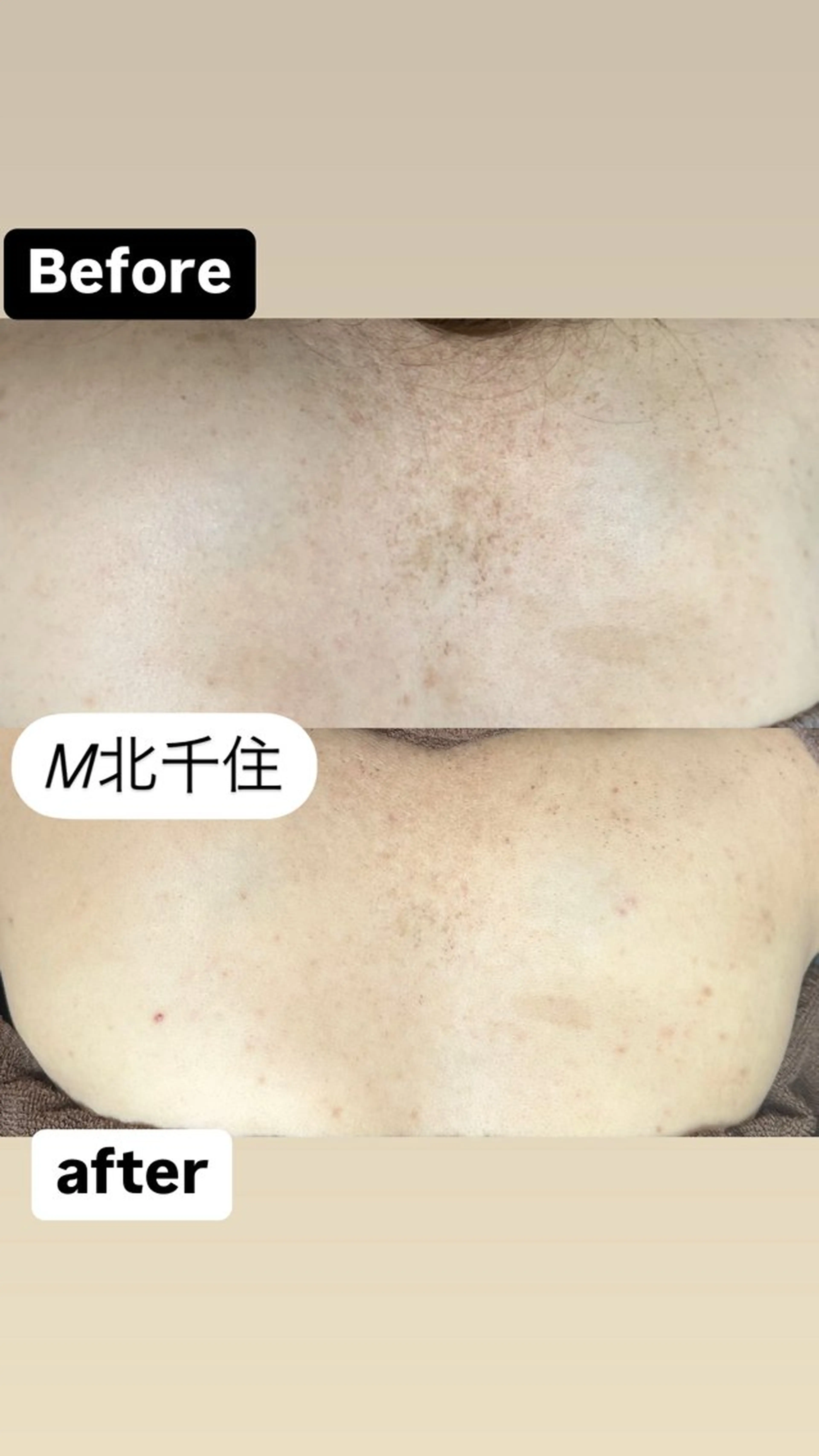 エステ Ma naのその他イメージ